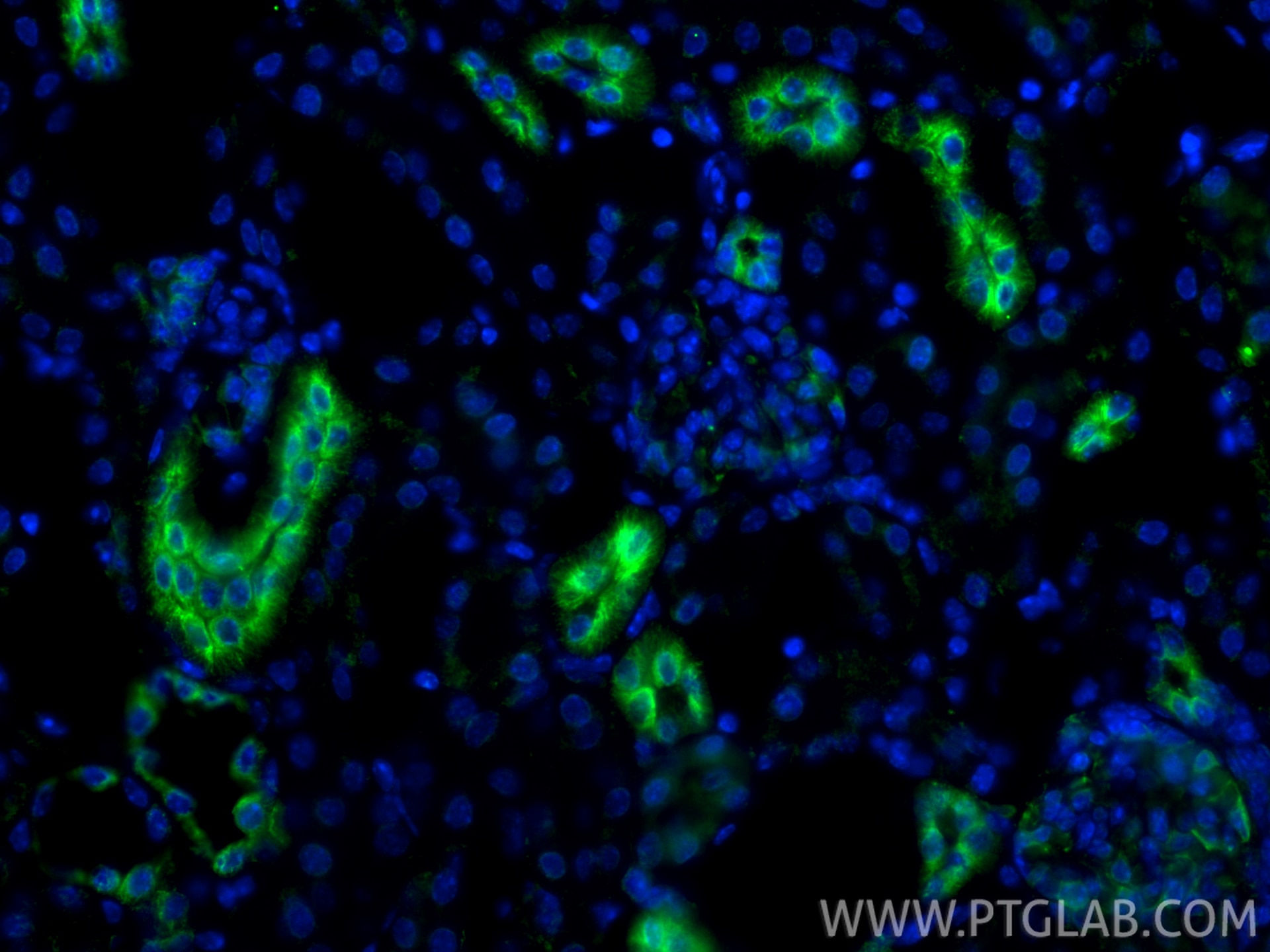 Immunofluorescence (IF) / fluorescent staining of mouse kidney tissue using calreticulin Recombinant monoclonal antibody (80017-1-RR)