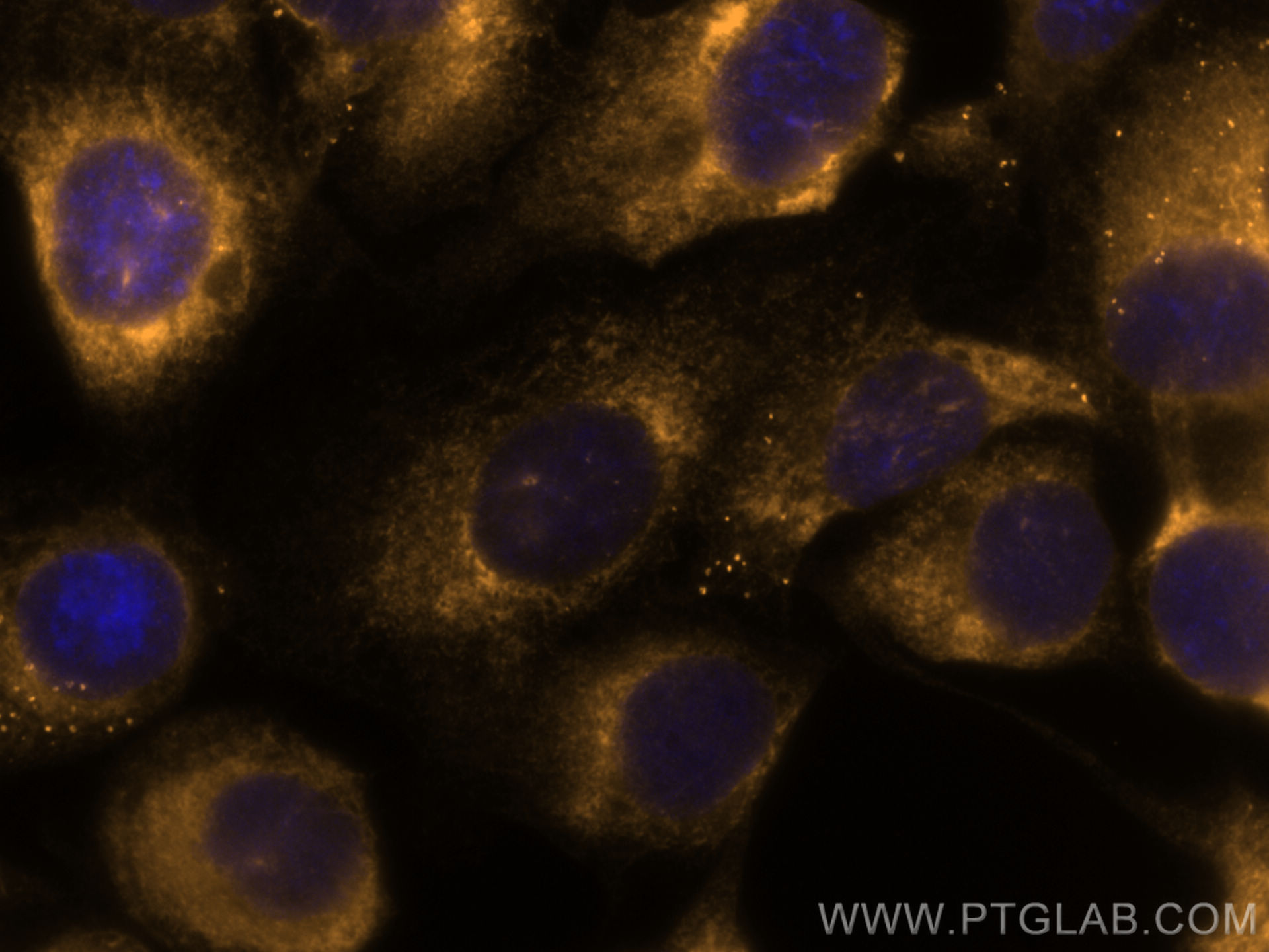 Immunofluorescence (IF) / fluorescent staining of SKOV-3 cells using CoraLite® Plus 555-conjugated calreticulin Polyclo (CL555-27298)