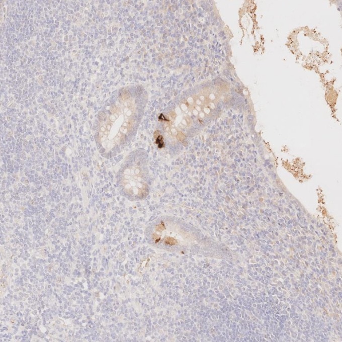 Immunohistochemistry (IHC) staining of human appendicitis tissue using Chromogranin A Monoclonal antibody (60135-2-Ig)