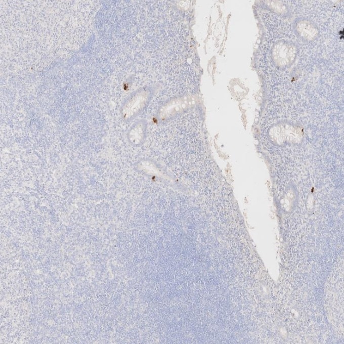Immunohistochemistry (IHC) staining of human appendicitis tissue using Chromogranin A Monoclonal antibody (60135-2-Ig)