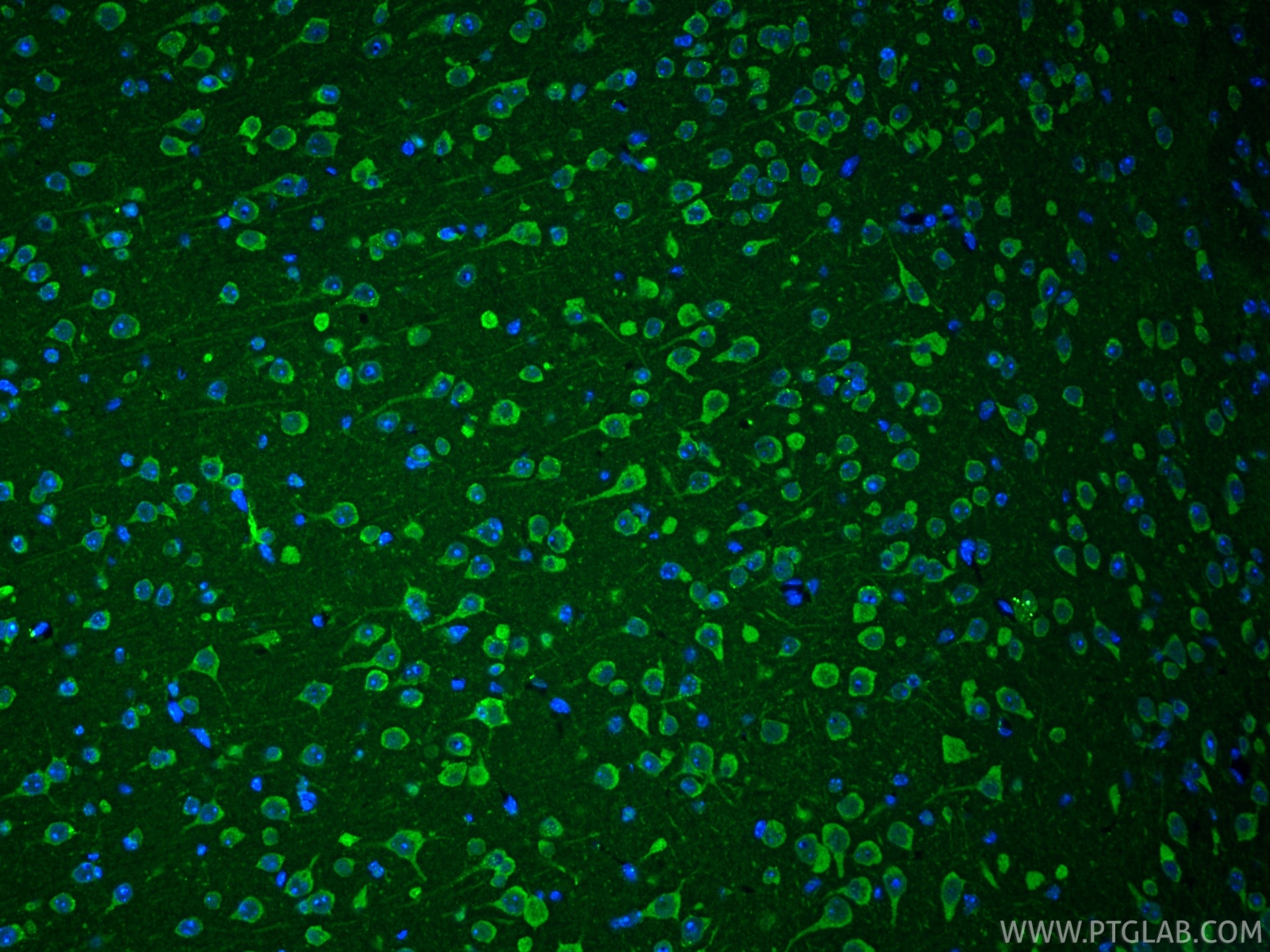 Immunofluorescence (IF) / fluorescent staining of mouse brain tissue using Cleaved Caspase 3 Polyclonal antibody (25128-1-AP)