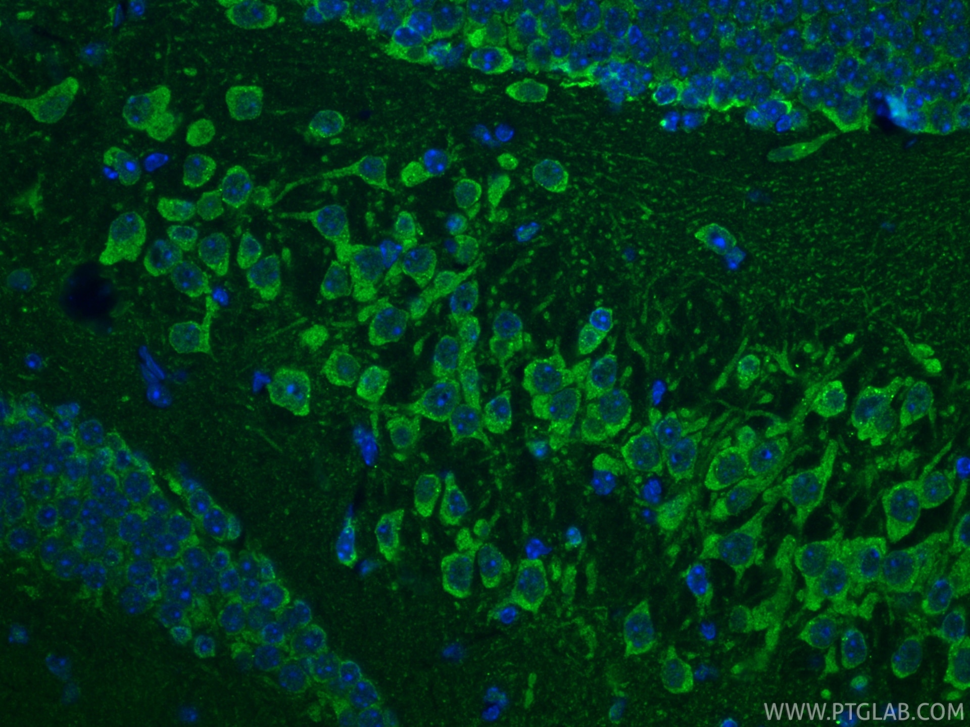 Immunofluorescence (IF) / fluorescent staining of mouse brain tissue using Cleaved Caspase 3 Polyclonal antibody (25128-1-AP)