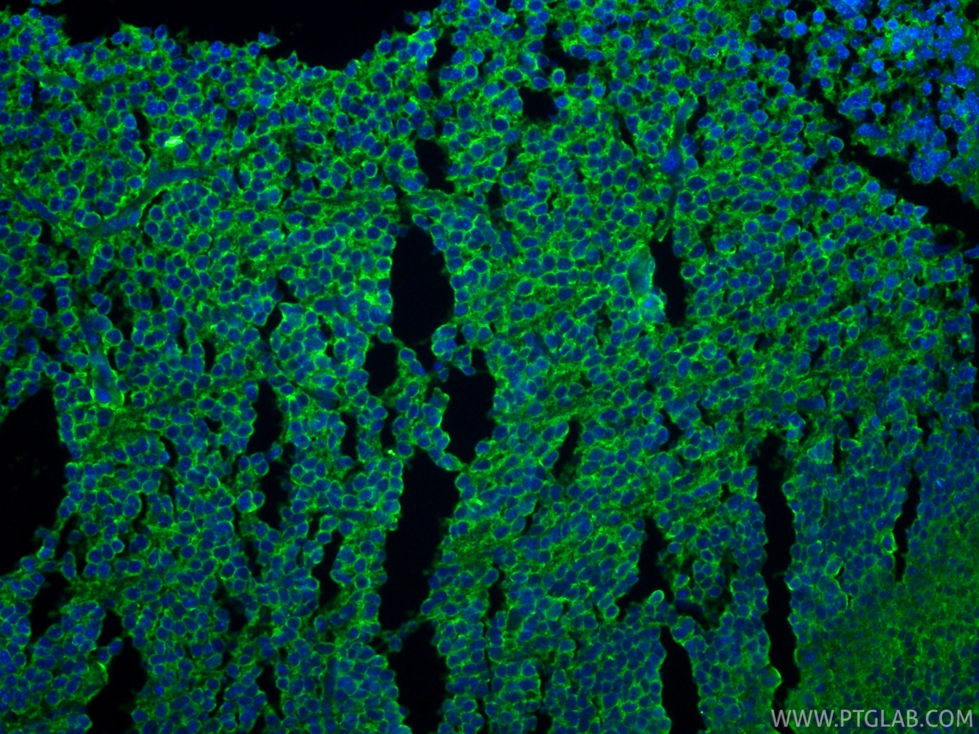 Immunofluorescence (IF) / fluorescent staining of mouse embryo tissue using Cleaved Caspase 3 Polyclonal antibody (25128-1-AP)