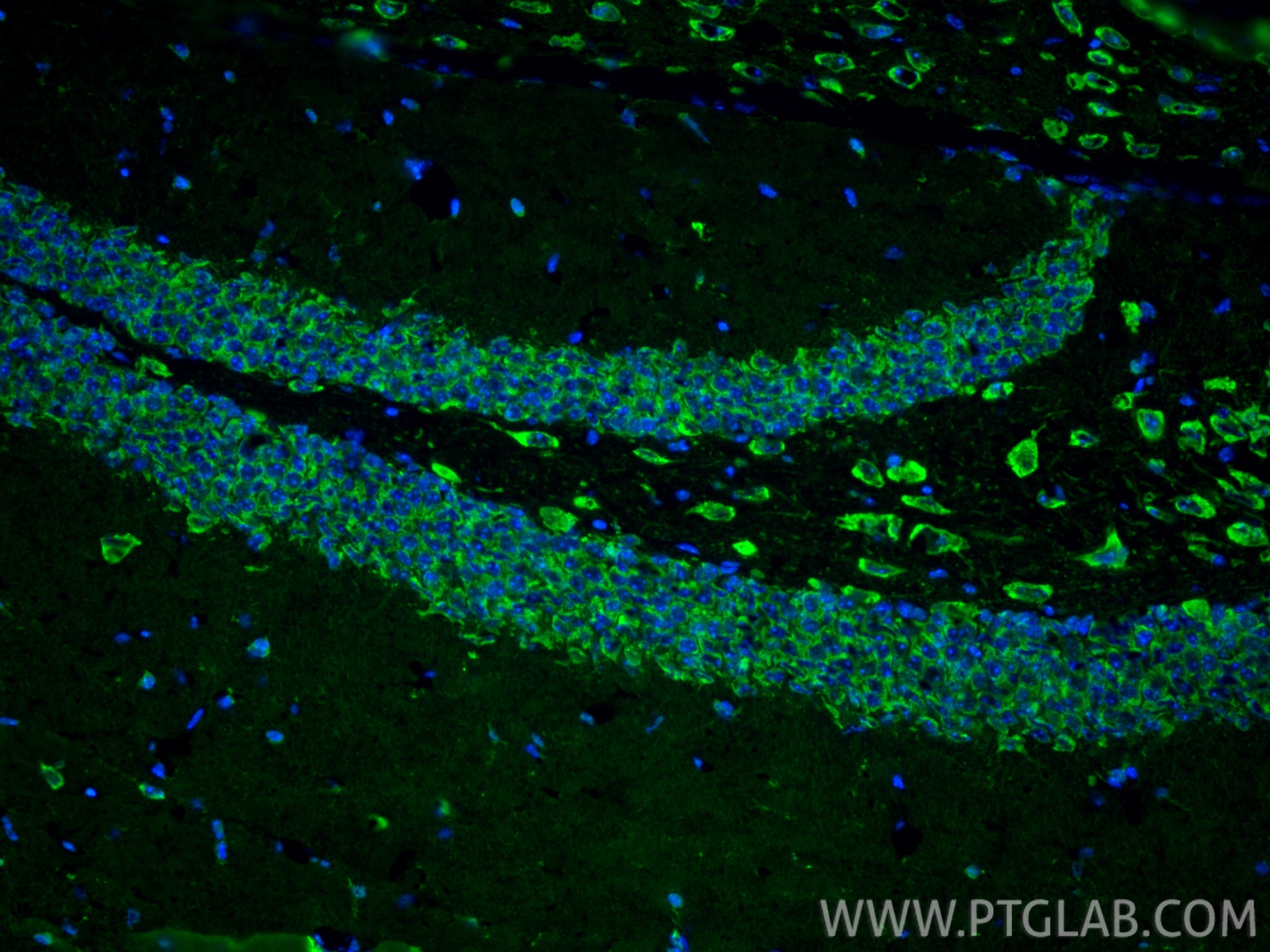Immunofluorescence (IF) / fluorescent staining of mouse brain tissue using Cleaved Caspase 3 Polyclonal antibody (25128-1-AP)