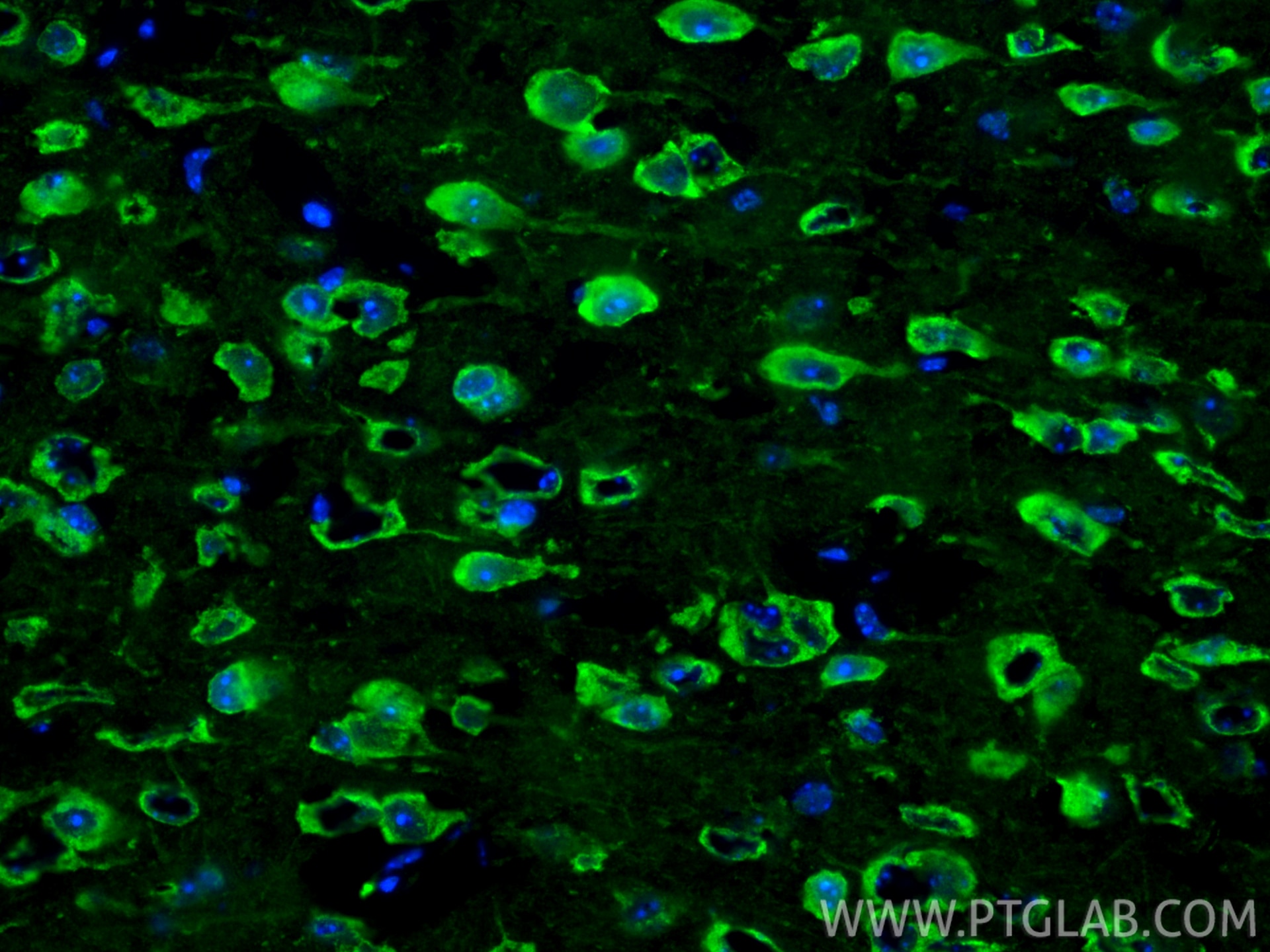 Immunofluorescence (IF) / fluorescent staining of mouse brain tissue using Cleaved Caspase 3 Polyclonal antibody (25128-1-AP)