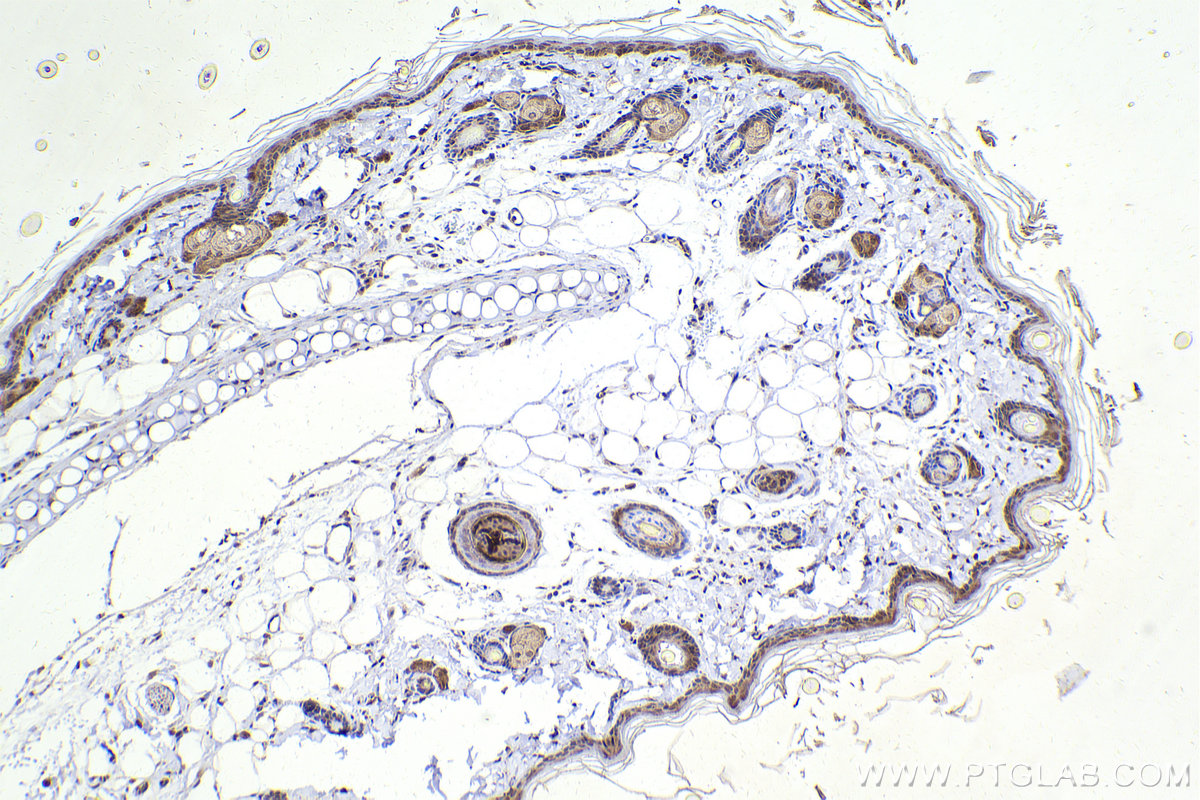 Immunohistochemistry (IHC) staining of rat skin tissue using cyclin B1 Monoclonal antibody (67686-1-Ig)