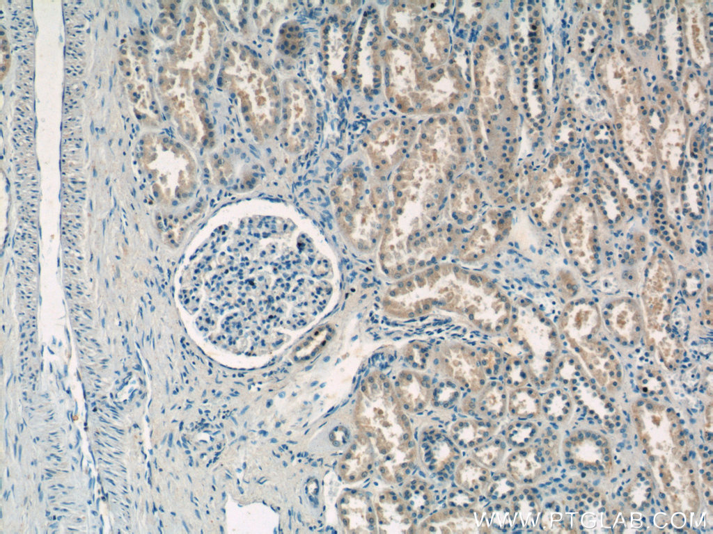 Immunohistochemistry (IHC) staining of human kidney tissue using domain-II-of-FIZ1 Polyclonal antibody (15827-1-AP)