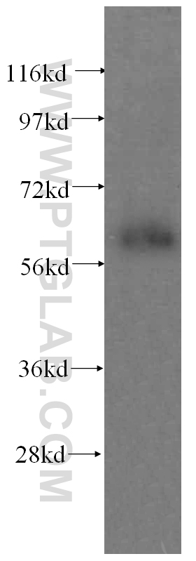 Western Blot (WB) analysis of human kidney tissue using domain-II-of-FIZ1 Polyclonal antibody (15827-1-AP)