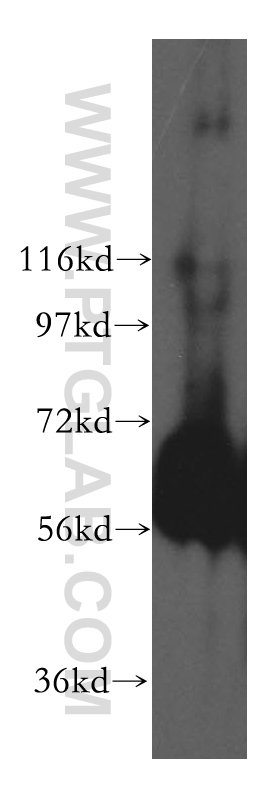 Western Blot (WB) analysis of human kidney tissue using domain-II-of-FIZ1 Polyclonal antibody (15827-1-AP)