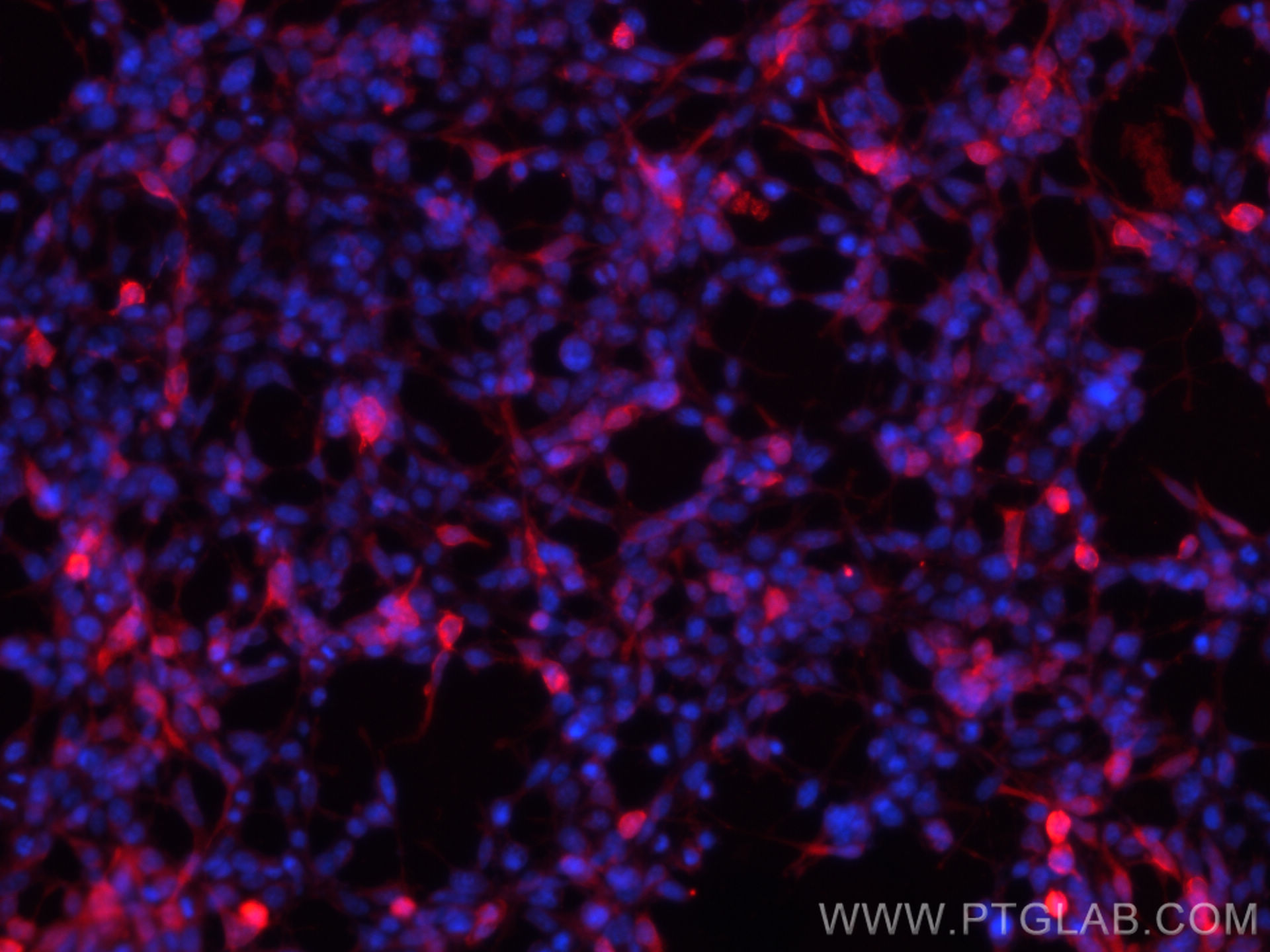 Immunofluorescence (IF) / fluorescent staining of Transfected HEK-293 cells using GFP tag Polyclonal antibody (50430-2-AP)