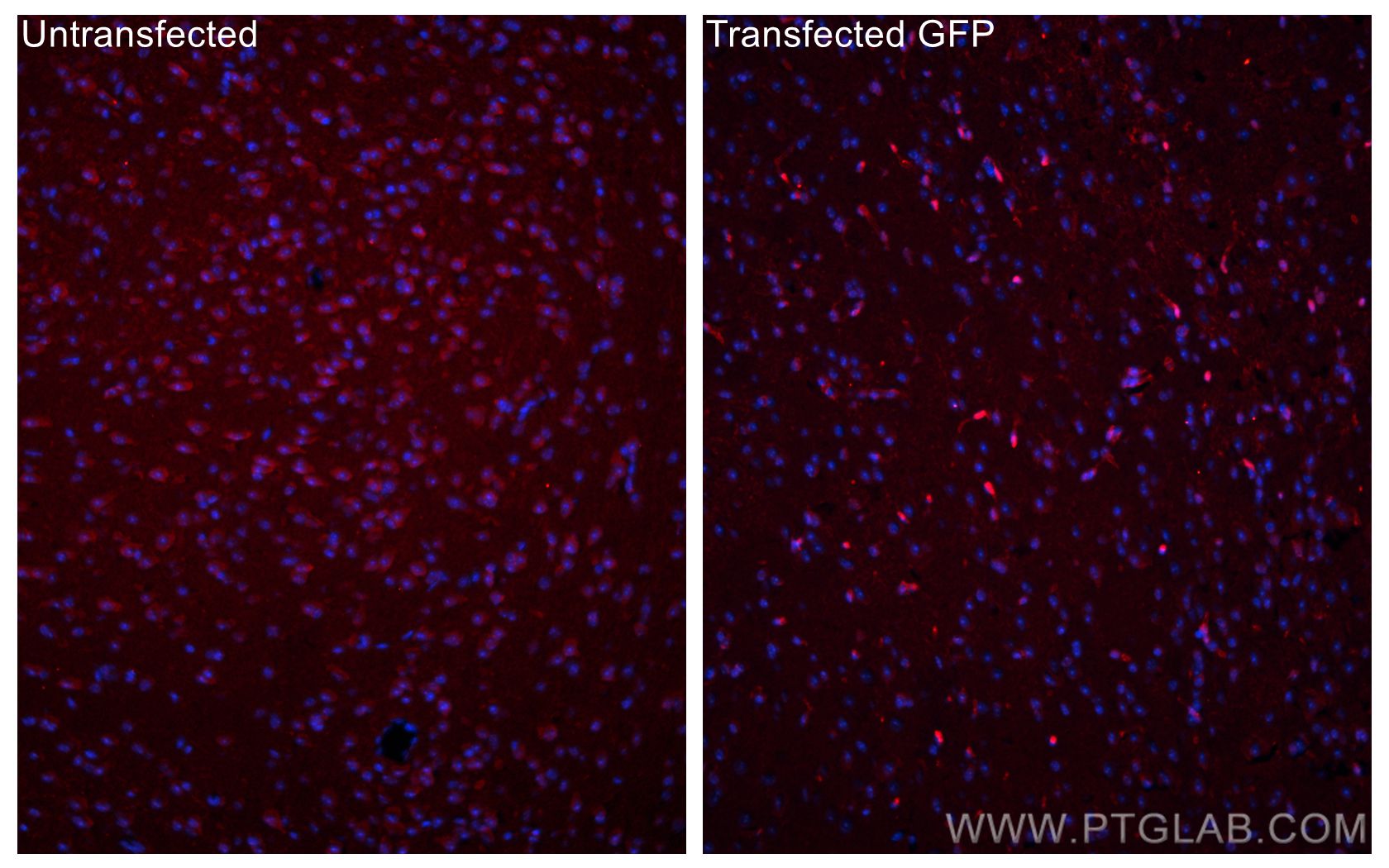 Immunofluorescence (IF) / fluorescent staining of mouse brain tissue using GFP tag Polyclonal antibody (50430-2-AP)