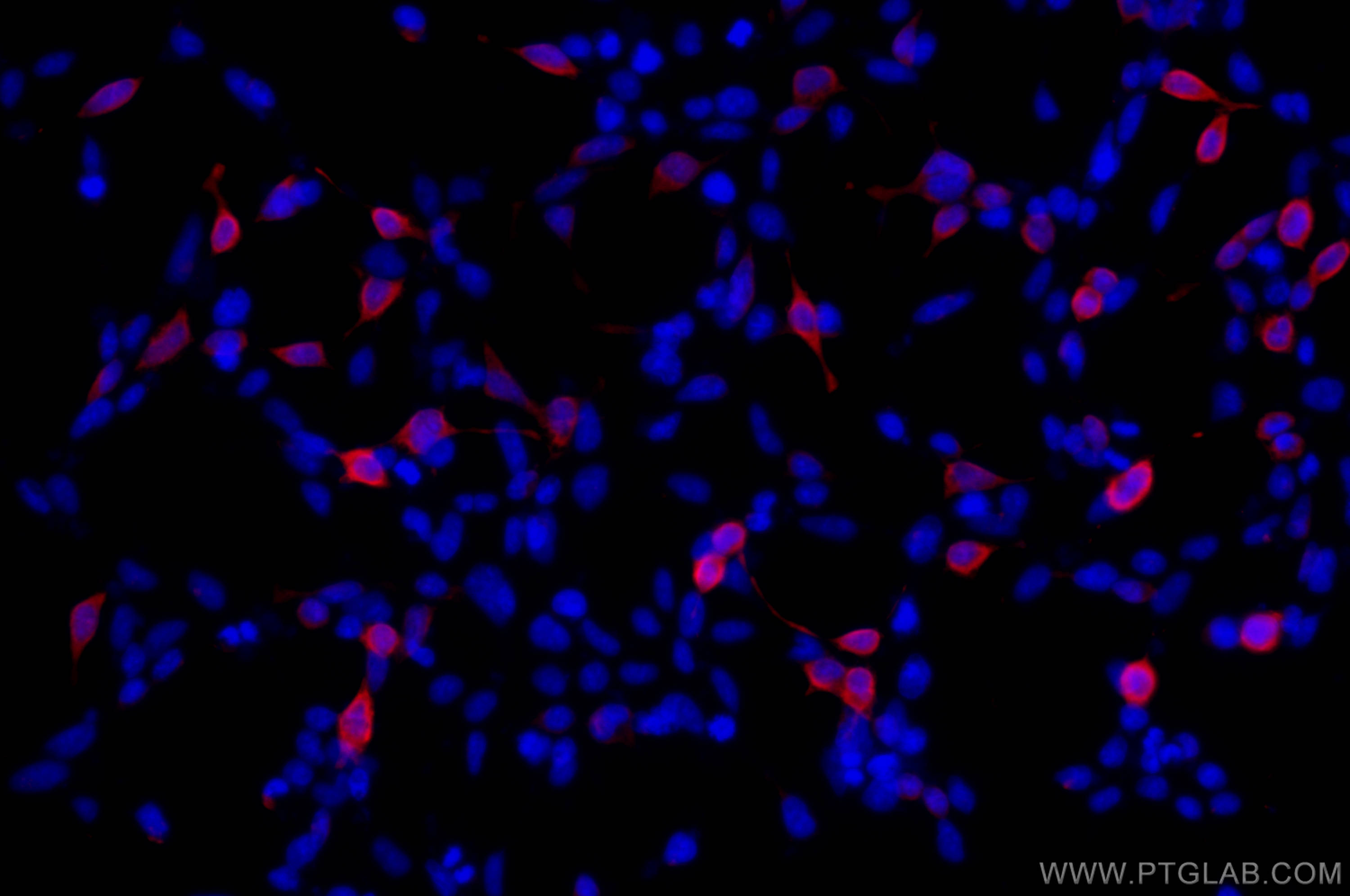 Immunofluorescence (IF) / fluorescent staining of Transfected HEK-293 cells using GFP tag Monoclonal antibody (66002-1-Ig)