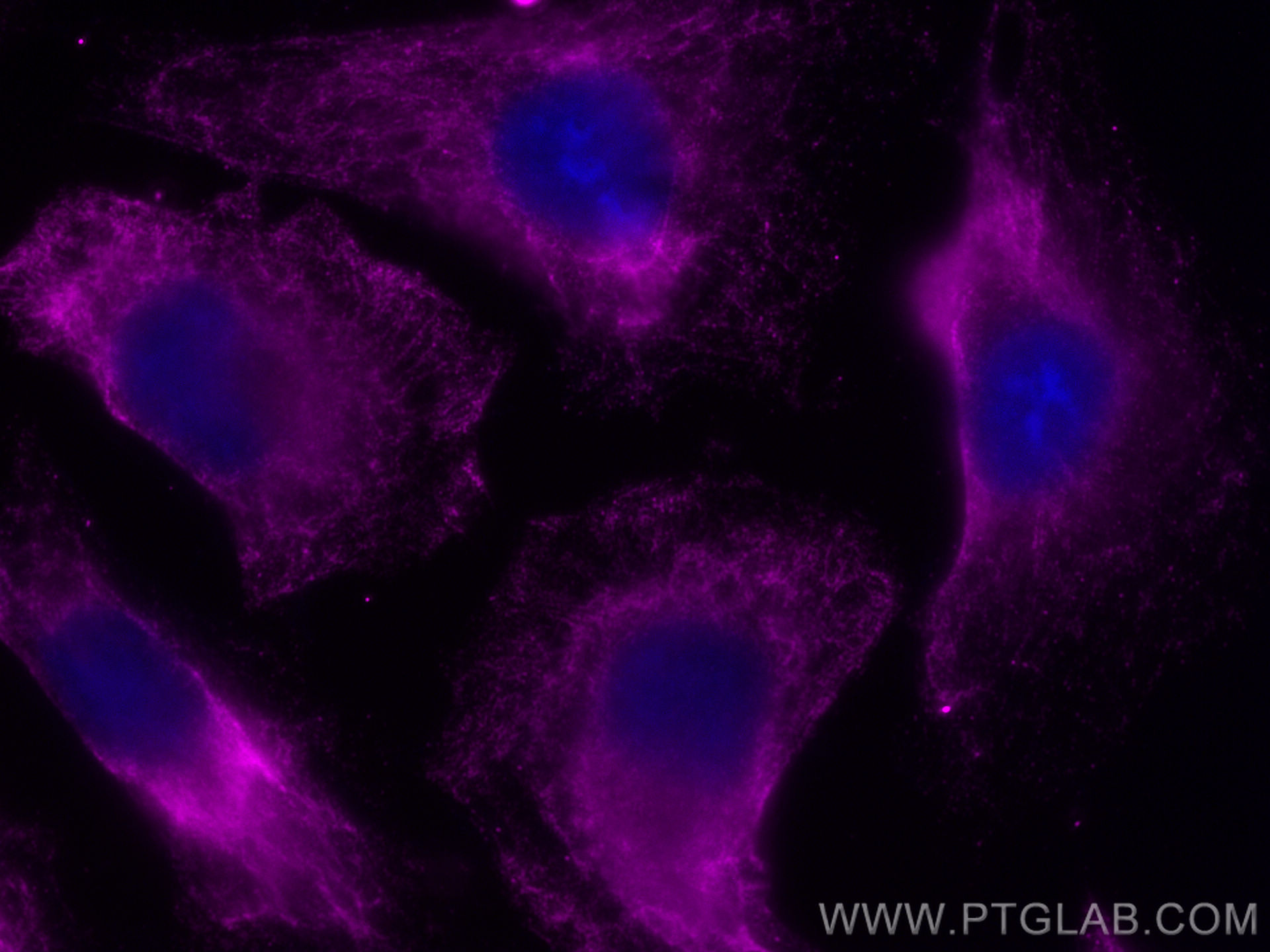 Immunofluorescence (IF) / fluorescent staining of HeLa cells using CoraLite® Plus 647-conjugated eIF4G2/DAP5 Monoclon (CL647-67428)