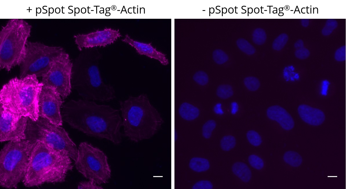 Left: HeLa cells transiently expressing pSpot Spot-Tag?-Actin (ev-31) were immunostained with Spot-Label? Alexa Fluor? 647 (magenta, ebAF647, 1:800) and DAPI (blue). Right: Control staining, no background noise; HeLa cells without pSpot Spot-Tag?-Actin expression were immunostained with Spot-Label? Alexa Fluor? 647 (magenta, ebAF647, 1:800) and DAPI (blue). Scale bar, 10 μm. Images were acquired with the Thermo Scientific CellInsight CX7, 20X objective.