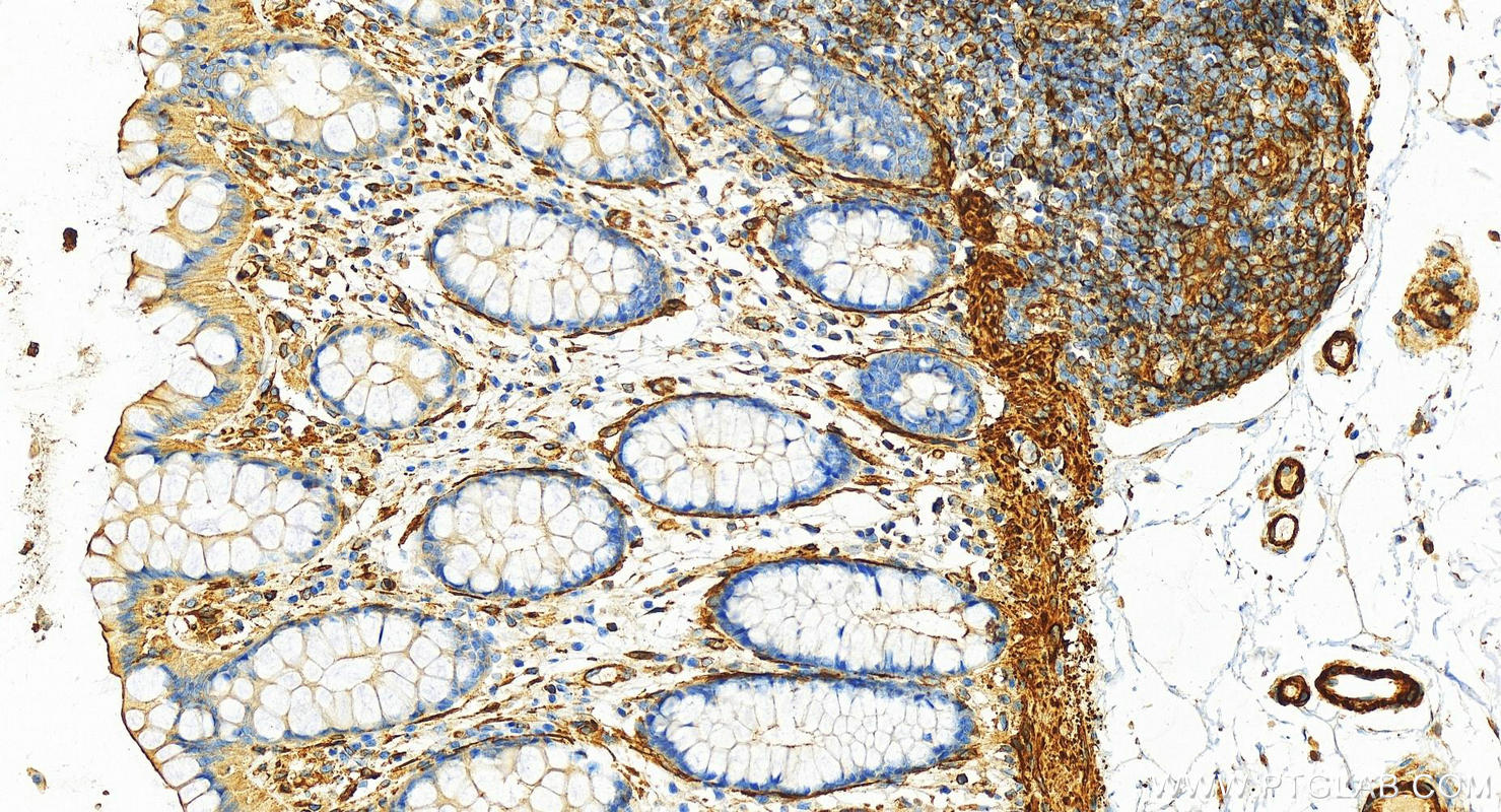 Immunohistochemistry (IHC) staining of human  colon using FLNC Polyclonal antibody (28492-1-AP)