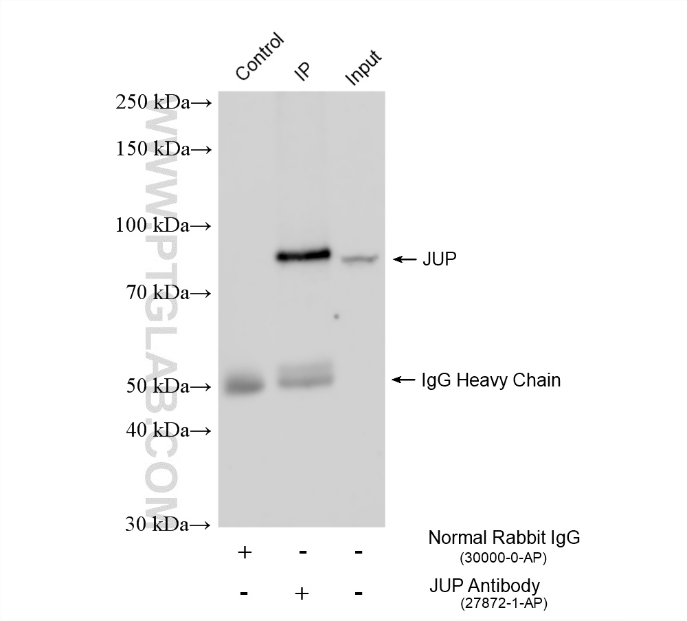 Immunoprecipitation (IP) experiment of mouse heart tissue using Gamma Catenin Polyclonal antibody (27872-1-AP)