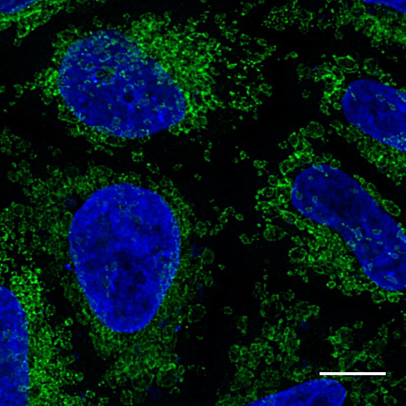 Confocal image of HeLa cells transiently transfected with Tom70-eGFP and immunostained with GFP-Booster Alexa Fluor 488 (green). Nuclei were stained with DAPI (blue). Scale bar, 10 μm. Images were recorded at the Core Facility Bioimaging at the Biomedical Center, LMU Munich.
