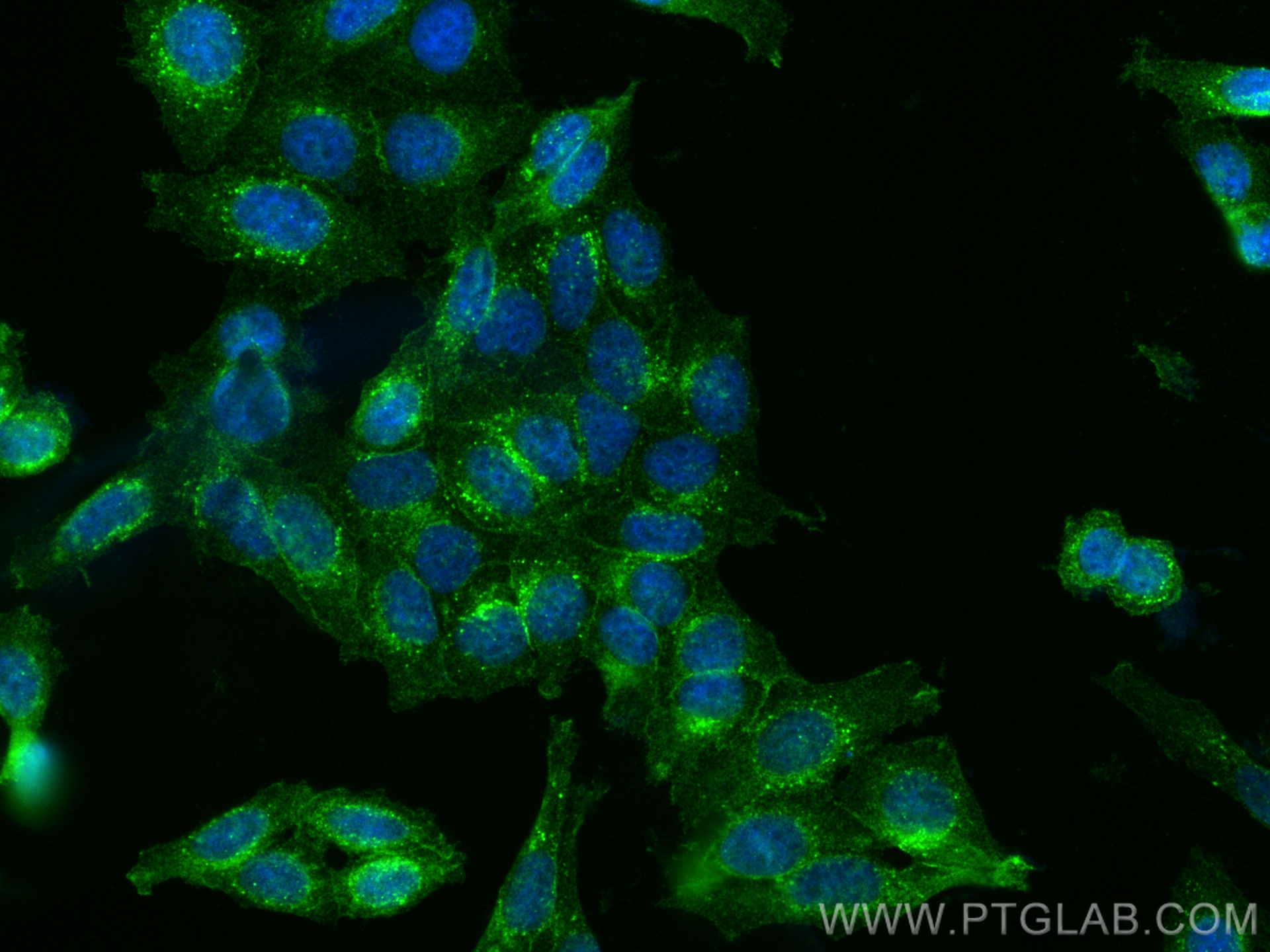 Immunofluorescence (IF) / fluorescent staining of HepG2 cells using gp130/IL6ST Polyclonal antibody (30591-1-AP)