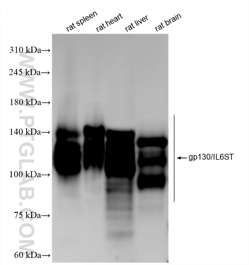 Western Blot (WB) analysis of various lysates using gp130/IL6ST Recombinant antibody (84113-5-RR)