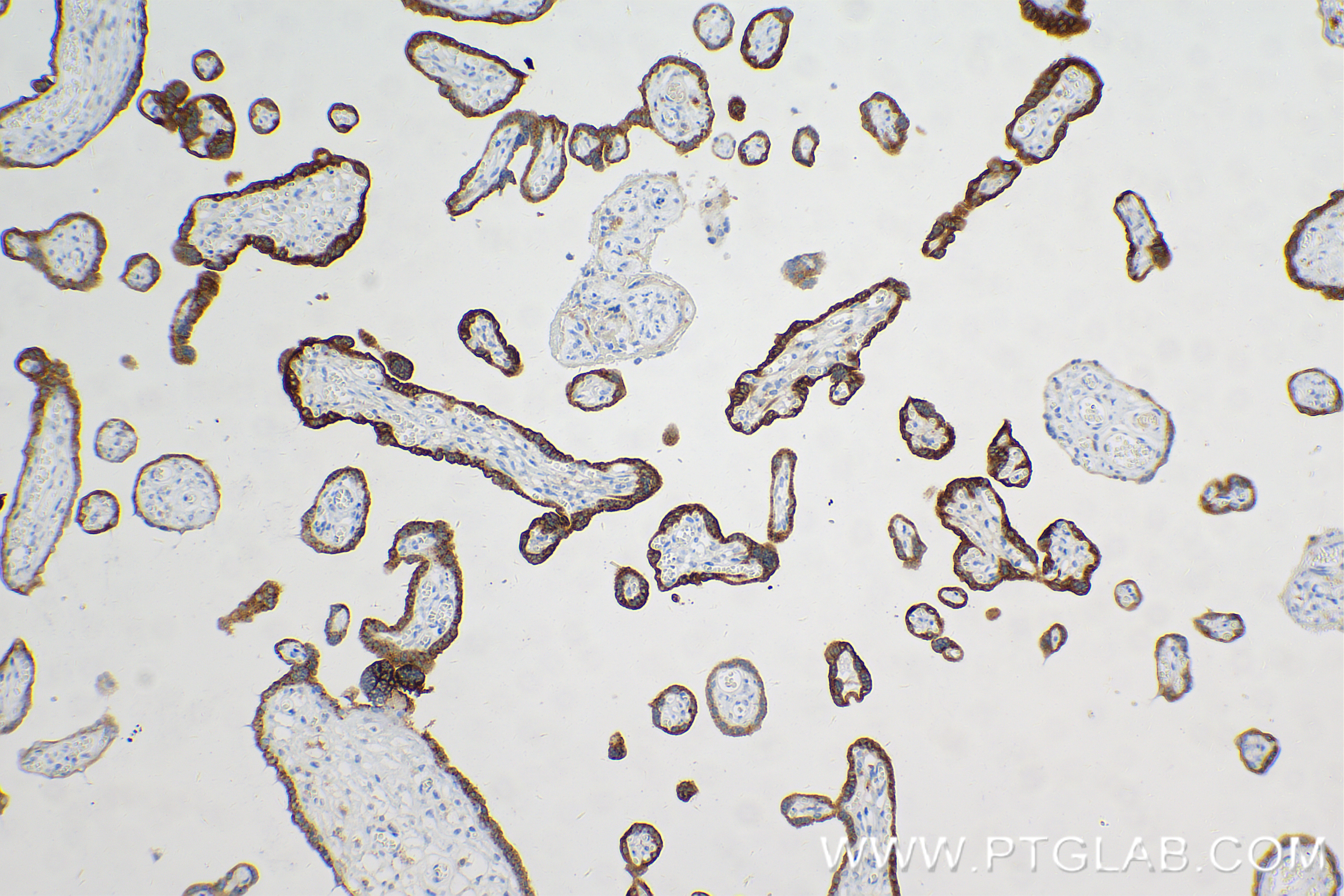Immunohistochemistry (IHC) staining of human placenta tissue using hCG Beta Recombinant antibody (85800-7-RR)