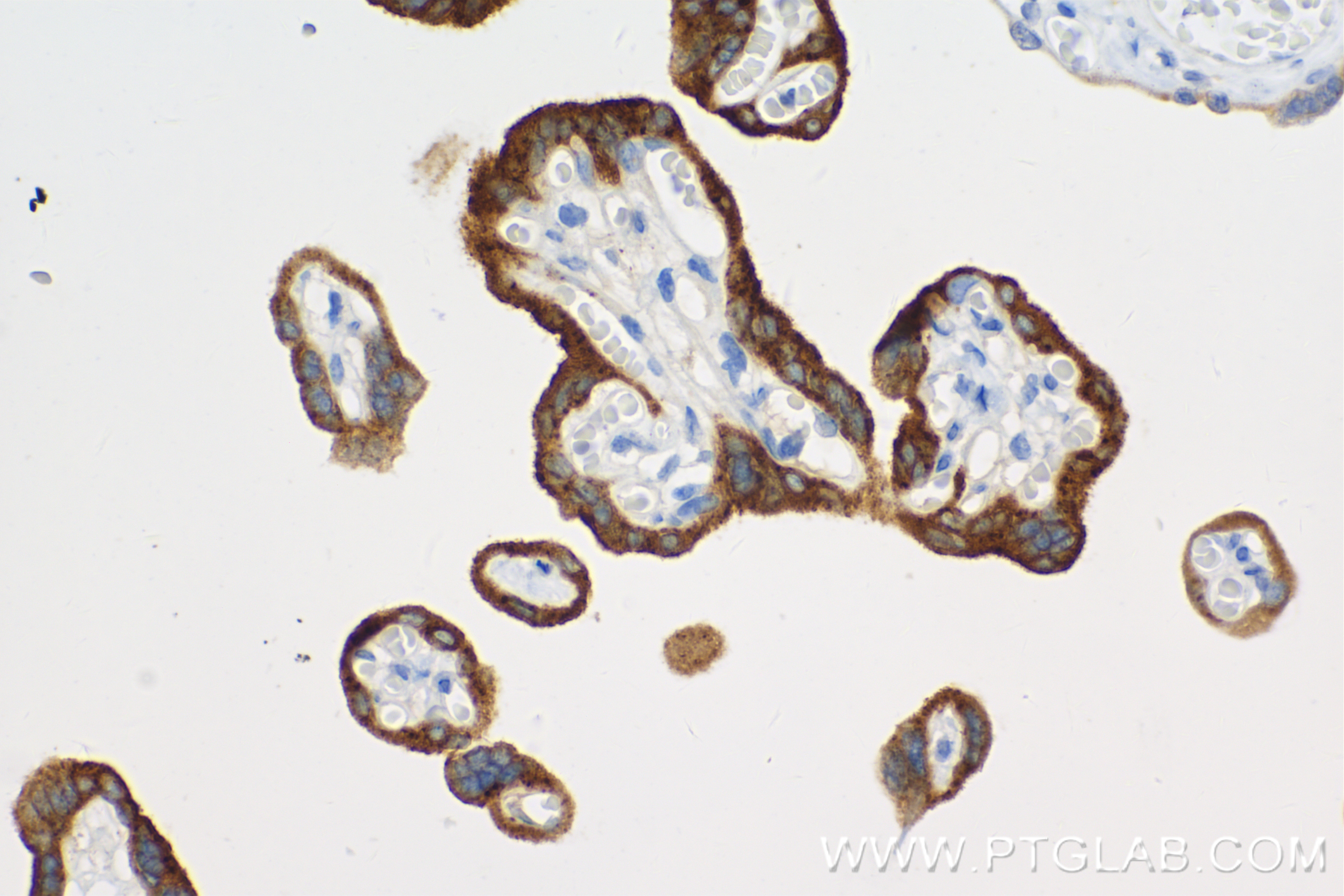 Immunohistochemistry (IHC) staining of human placenta tissue using hCG Beta Recombinant antibody (85800-7-RR)