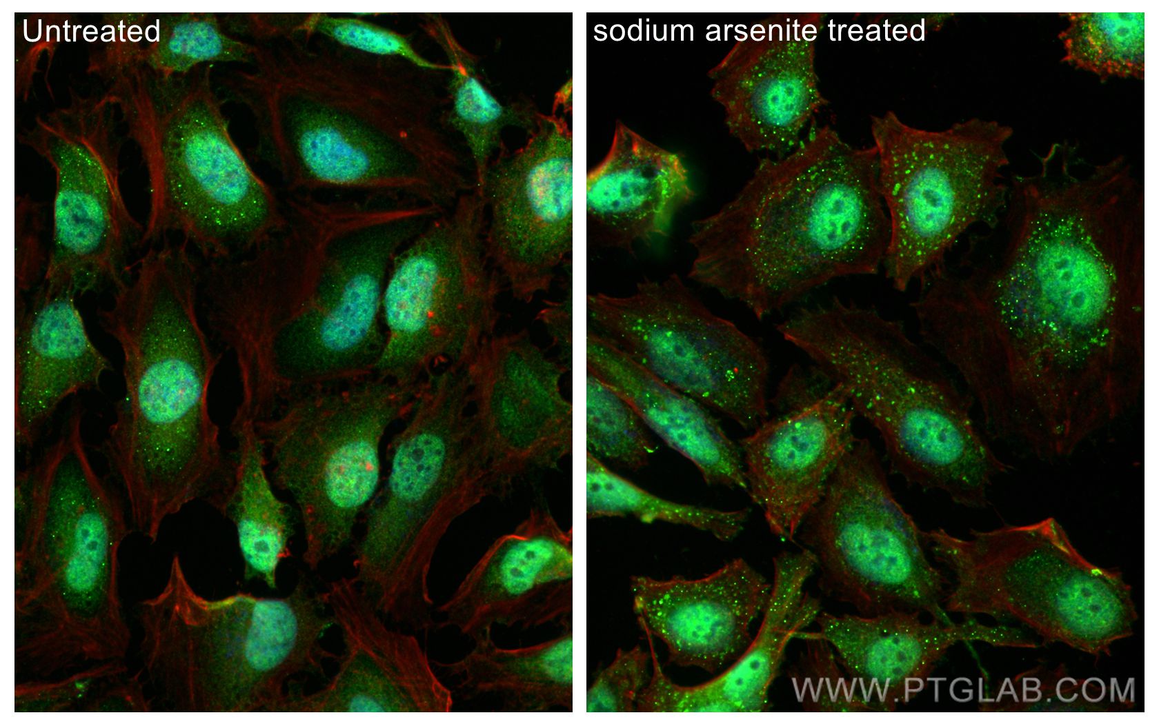 Immunofluorescence (IF) / fluorescent staining of HeLa cells using hnRNP-E1 Polyclonal antibody (14523-1-AP)