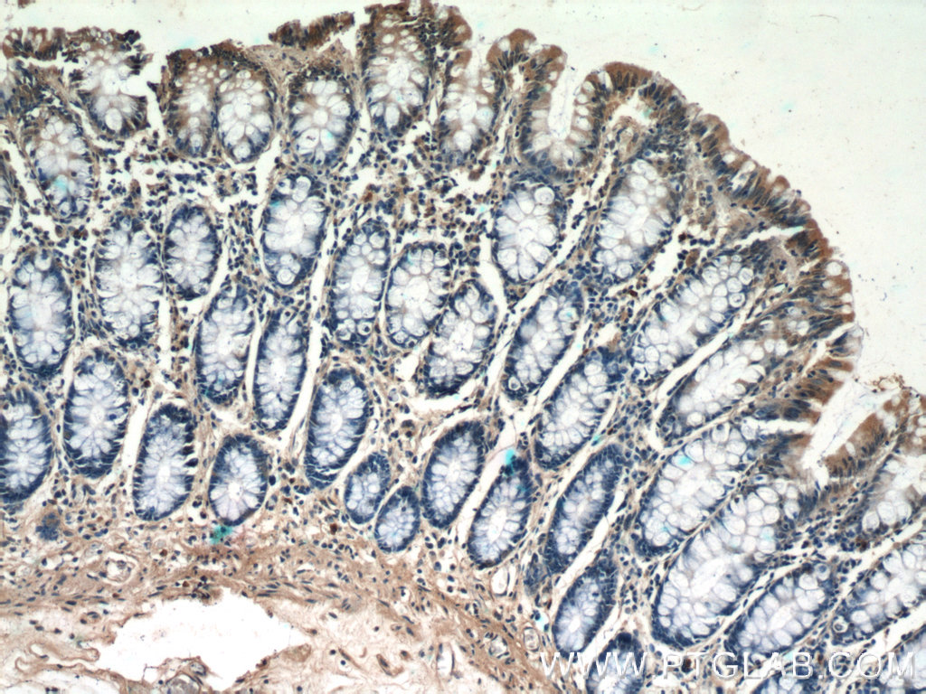 Immunohistochemistry (IHC) staining of human colon tissue using humanin Polyclonal antibody (25885-1-AP)