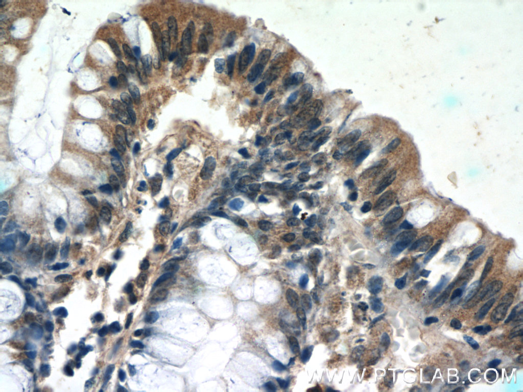 Immunohistochemistry (IHC) staining of human colon tissue using humanin Polyclonal antibody (25885-1-AP)