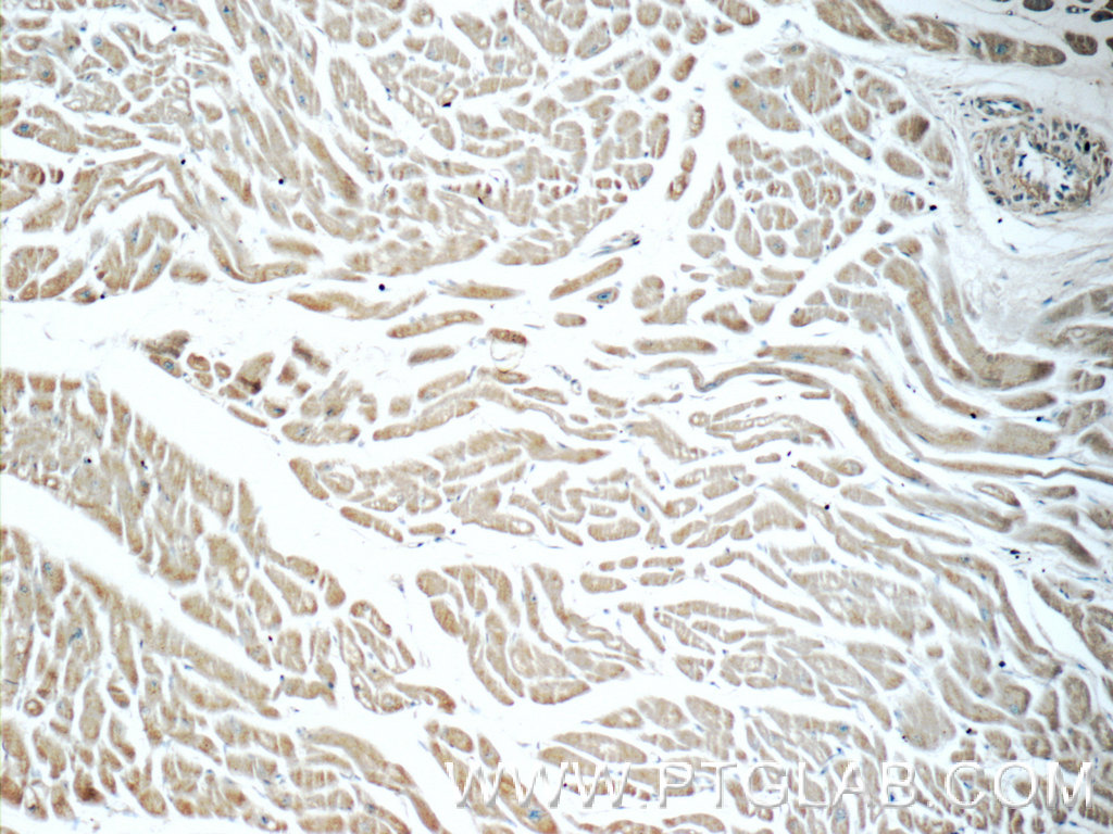 Immunohistochemistry (IHC) staining of human heart tissue using humanin Polyclonal antibody (25885-1-AP)