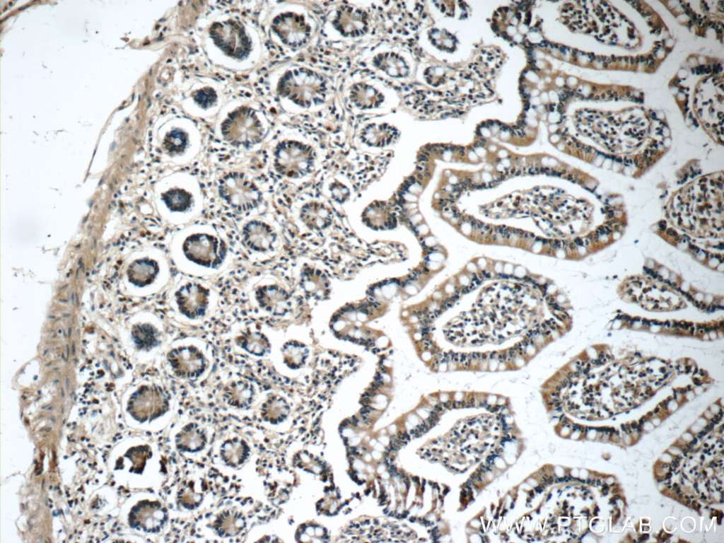 Immunohistochemistry (IHC) staining of human small intestine tissue using humanin Polyclonal antibody (25885-1-AP)