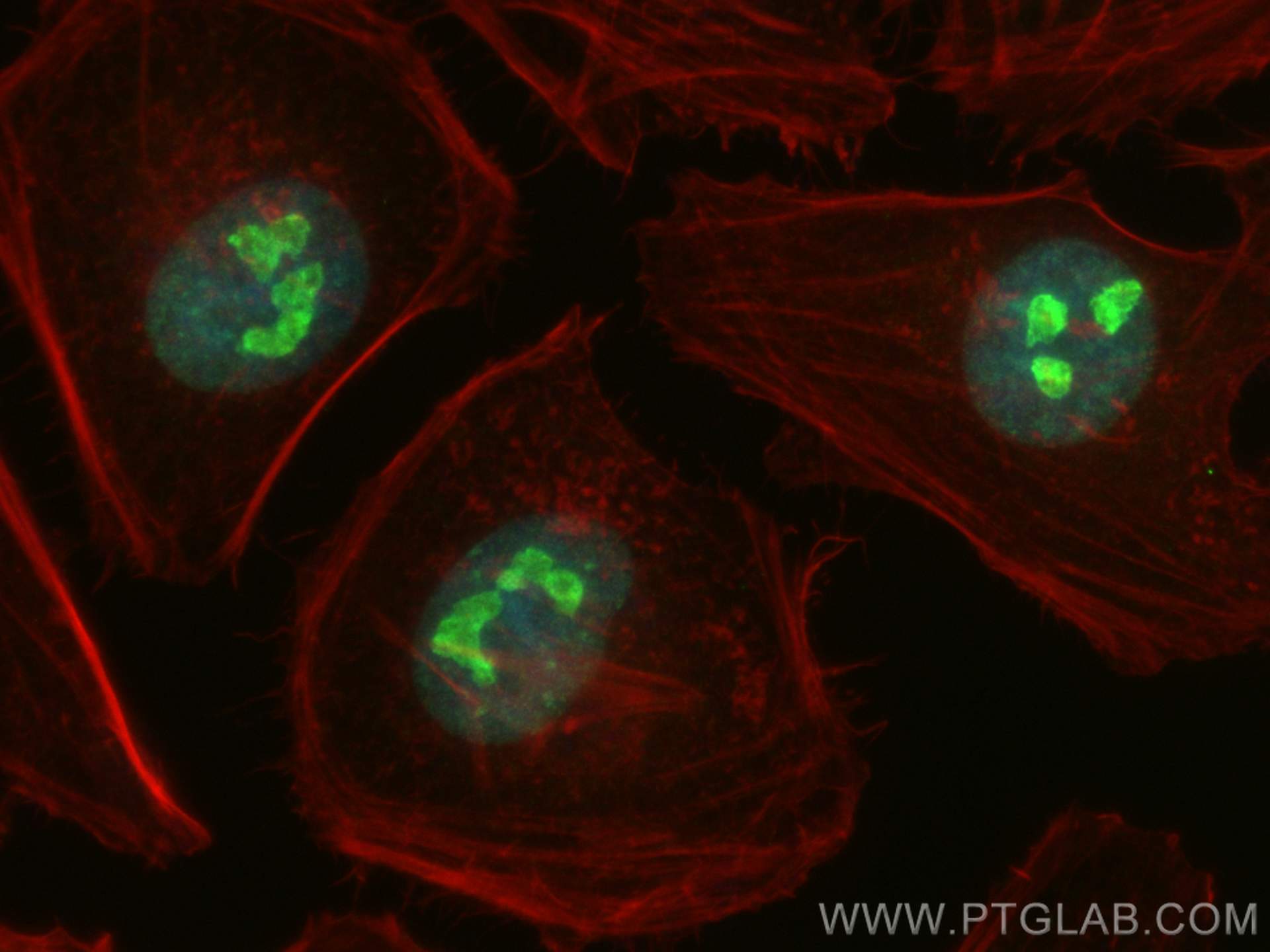 Immunofluorescence (IF) / fluorescent staining of HeLa cells using ki67 Polyclonal antibody (28074-1-AP)