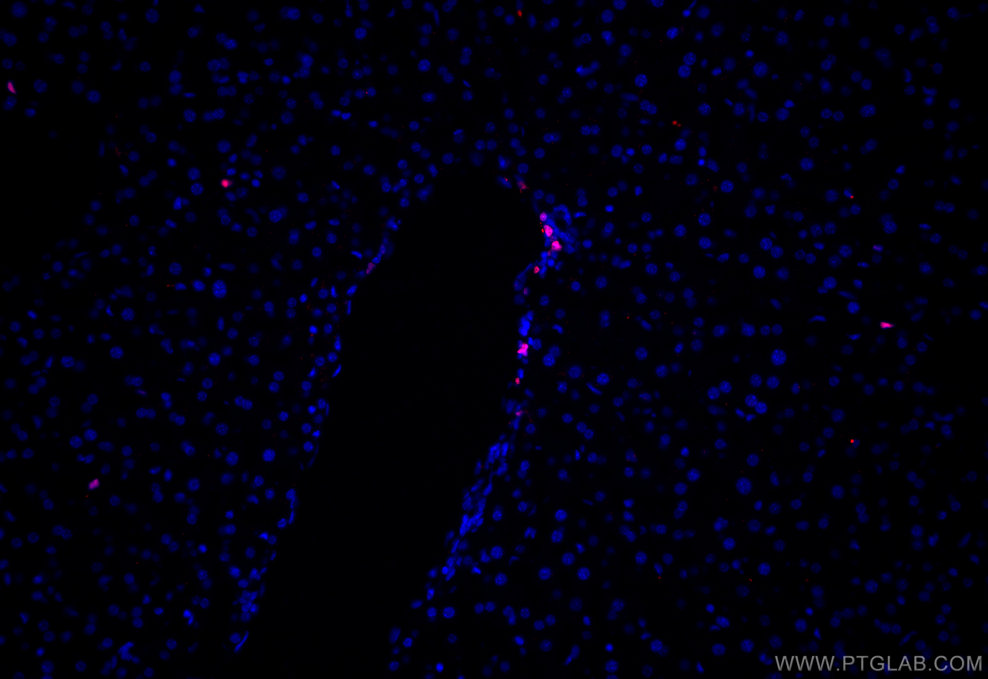 Immunofluorescence (IF) / fluorescent staining of mouse liver tissue using Ki-67 Polyclonal antibody (28074-1-AP)