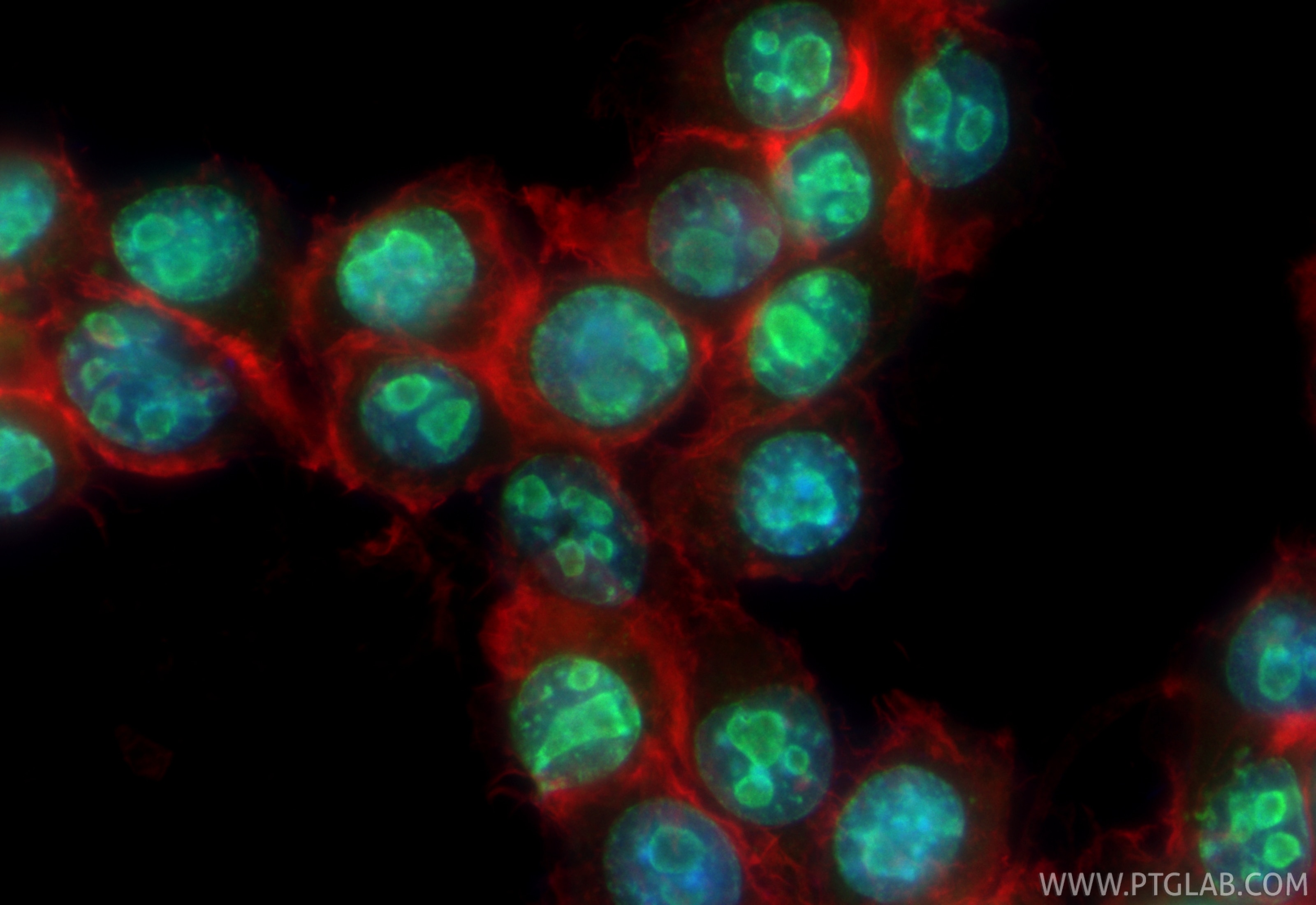 Immunofluorescence (IF) / fluorescent staining of BV-2 cells using Ki-67 Polyclonal antibody (28074-1-AP)