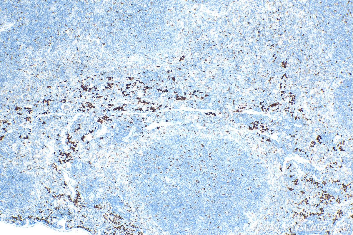 Immunohistochemistry (IHC) staining of mouse spleen tissue using Ki-67 Polyclonal antibody (28074-1-AP)