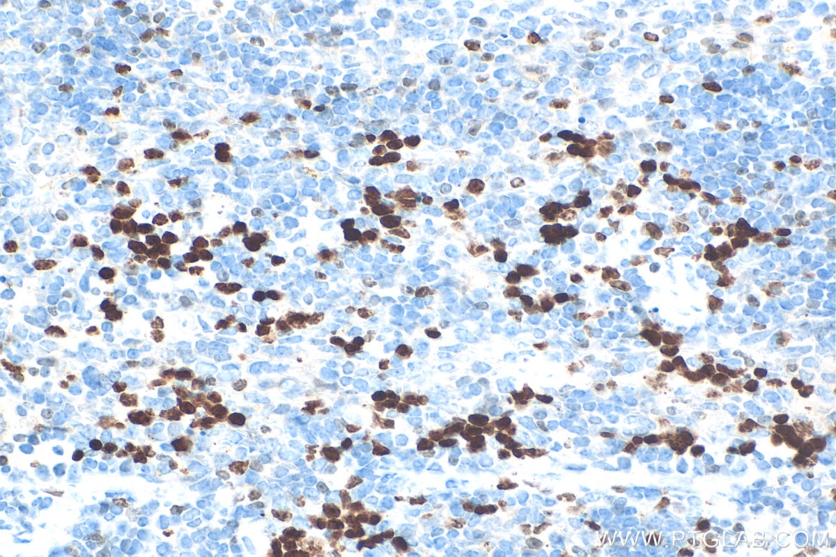 Immunohistochemistry (IHC) staining of mouse spleen tissue using Ki-67 Polyclonal antibody (28074-1-AP)