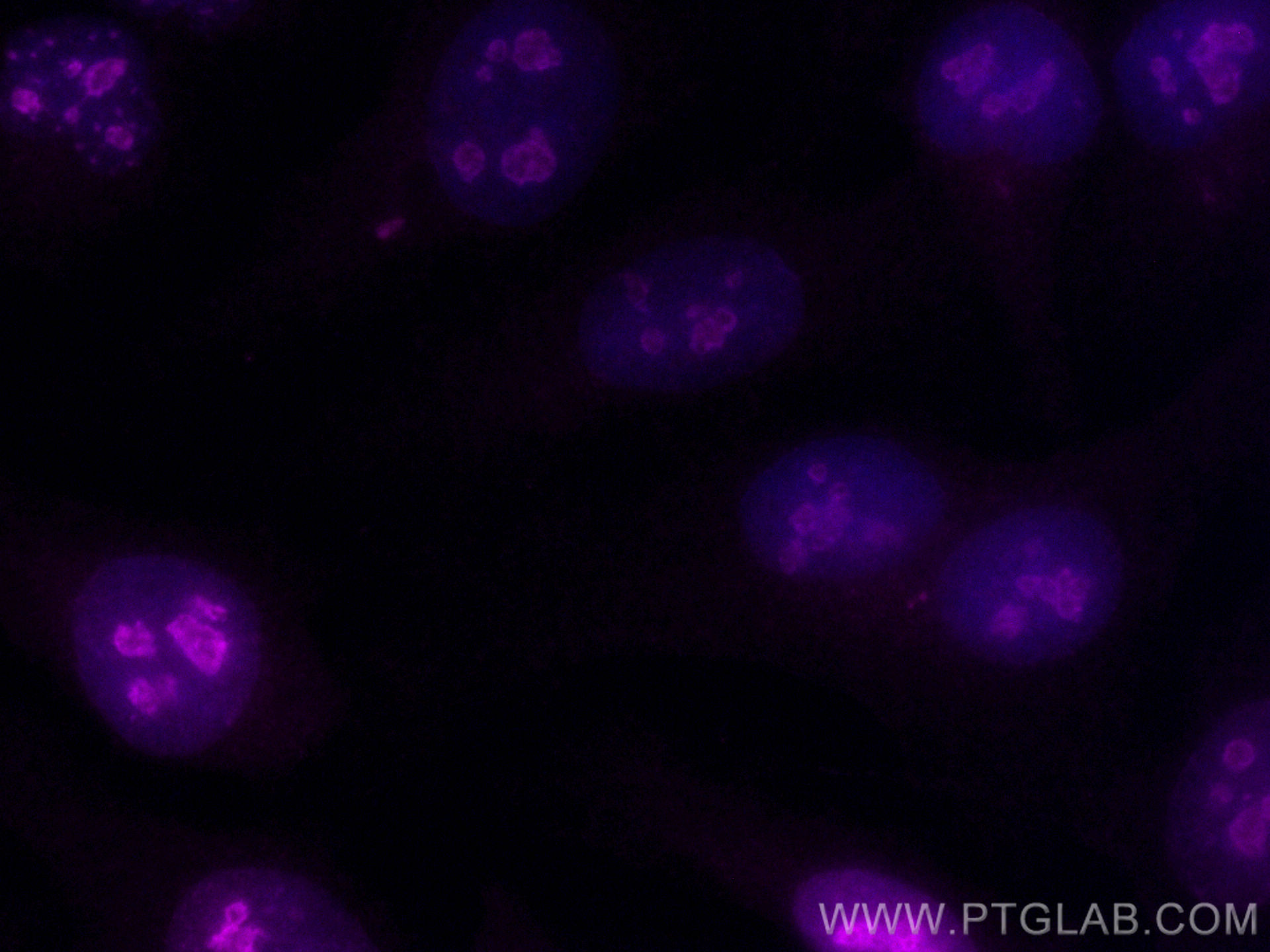 Immunofluorescence (IF) / fluorescent staining of HeLa cells using CoraLite® Plus 647-conjugated ki67 Polyclonal anti (CL647-28074)