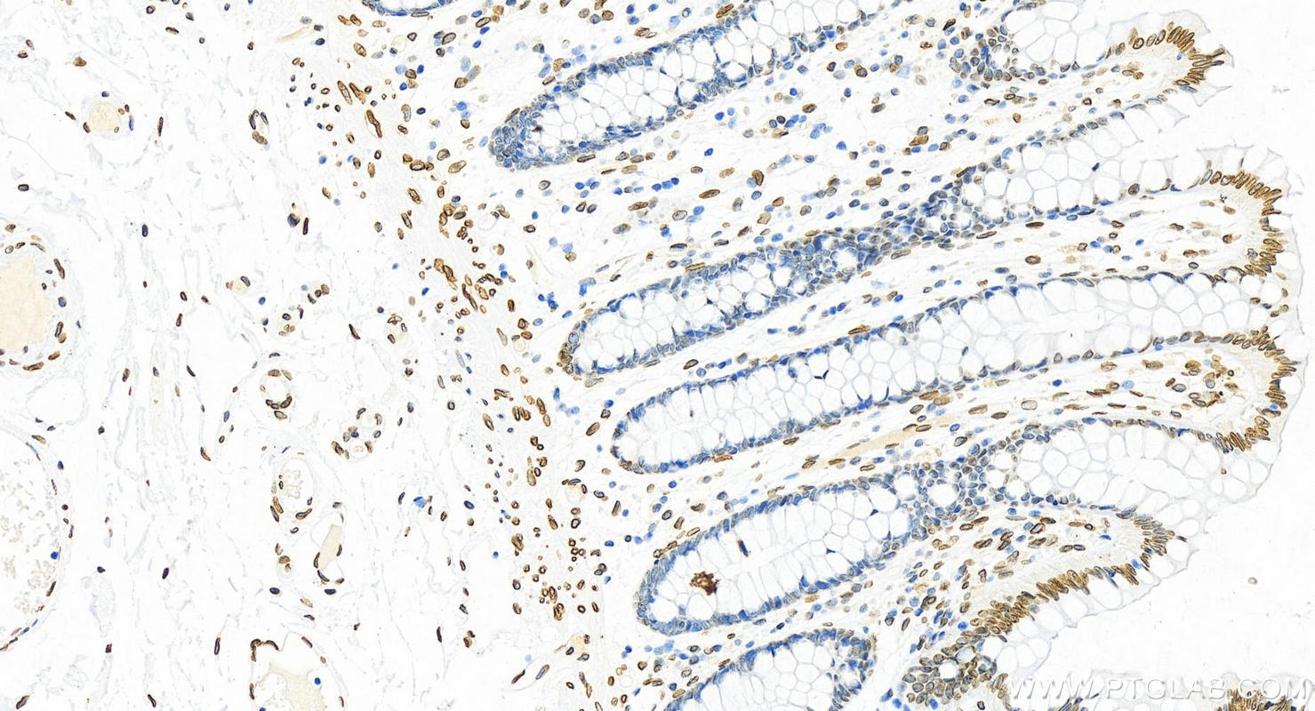 Immunohistochemistry (IHC) staining of human normal colon using Lamin A/C Polyclonal antibody (10298-1-AP)