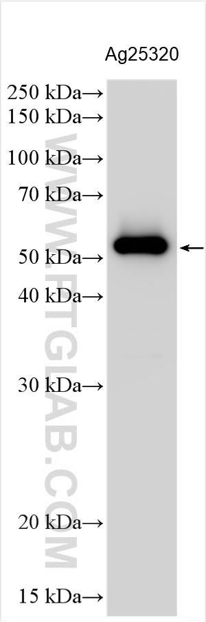 Western Blot (WB) analysis of various lysates using mCherry Polyclonal antibody (26765-1-AP)