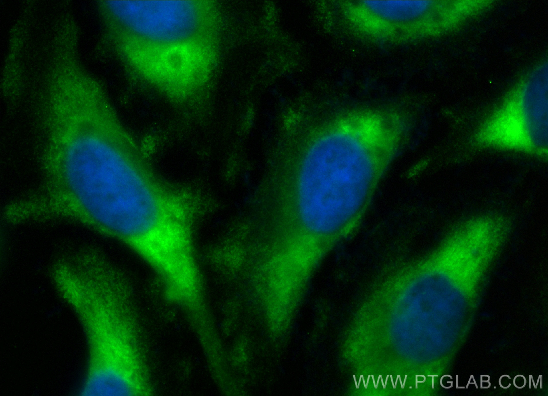 Immunofluorescence (IF) / fluorescent staining of HeLa cells using CoraLite® Plus 488-conjugated mTOR Polyclonal anti (CL488-28273)