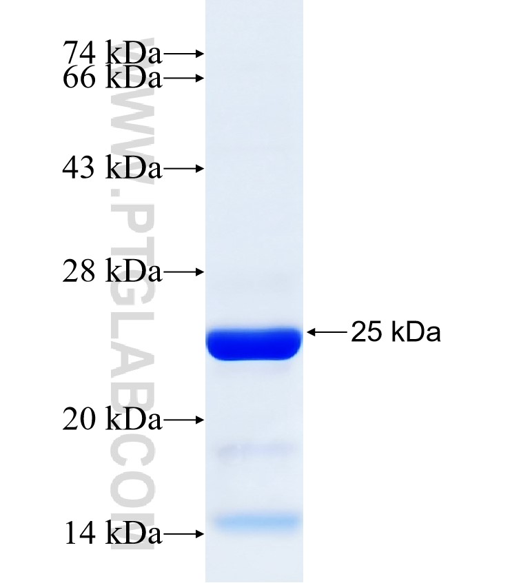 mmp24 fusion protein Ag31597 SDS-PAGE