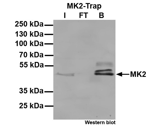 Immunoprecipitation of MK2: Western blot
I: Input, FT: Flow-through, B: Bound.
