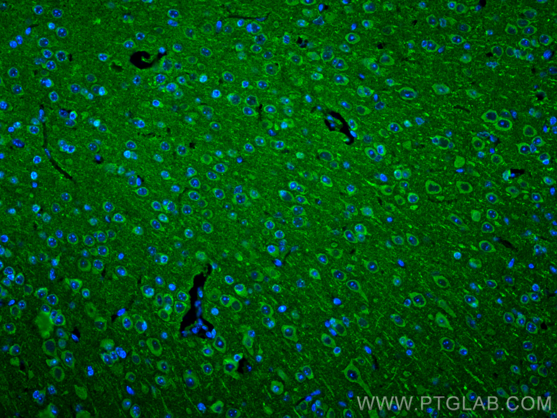 Immunofluorescence (IF) / fluorescent staining of mouse brain tissue using nNOS Polyclonal antibody (18984-1-AP)