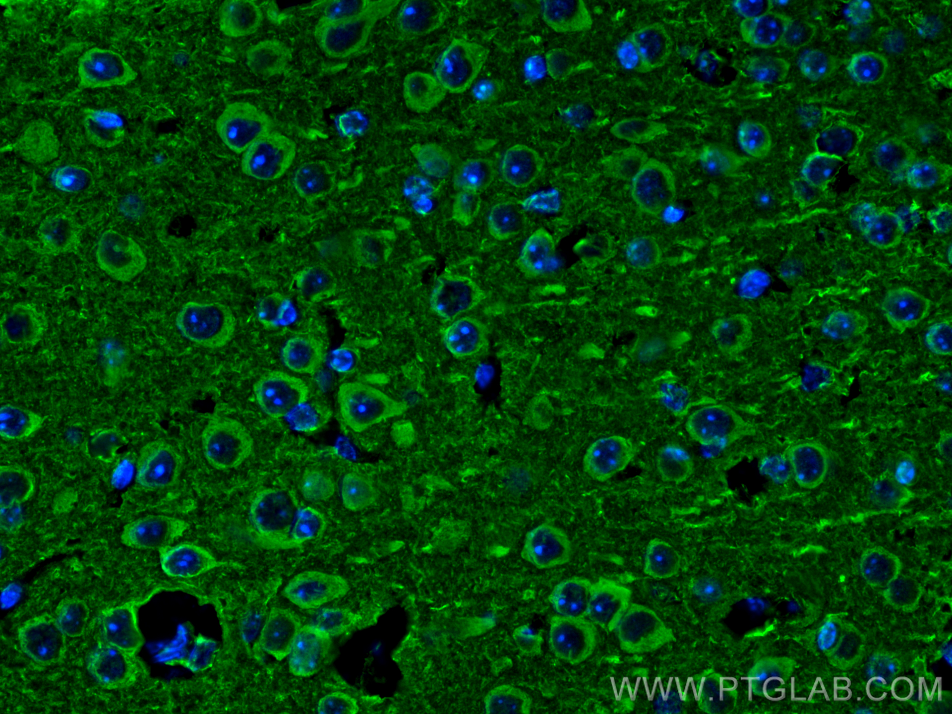 Immunofluorescence (IF) / fluorescent staining of mouse brain tissue using nNOS Polyclonal antibody (18984-1-AP)