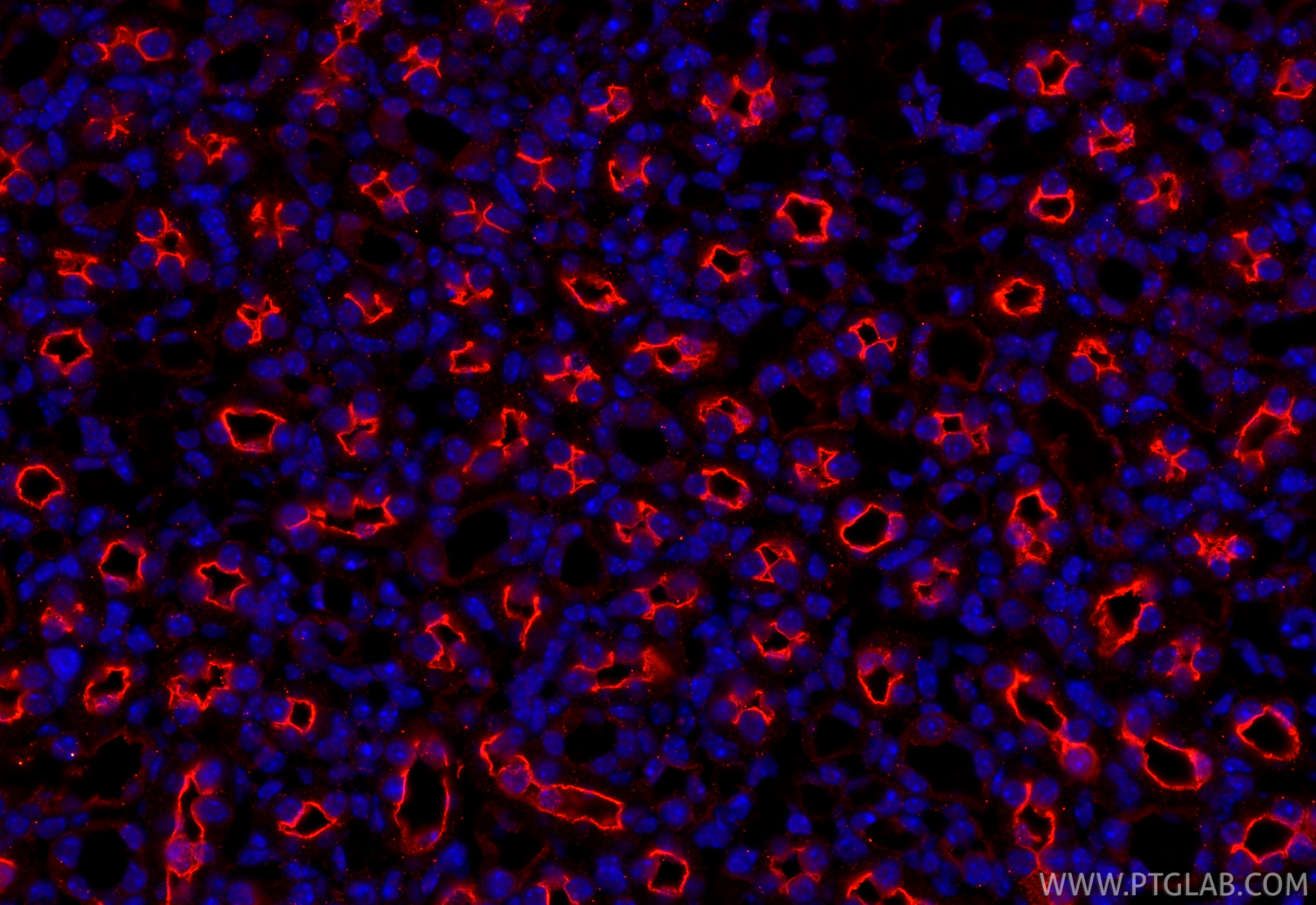 Immunofluorescence (IF) / fluorescent staining of mouse kidney tissue using nNOS Polyclonal antibody (18984-1-AP)