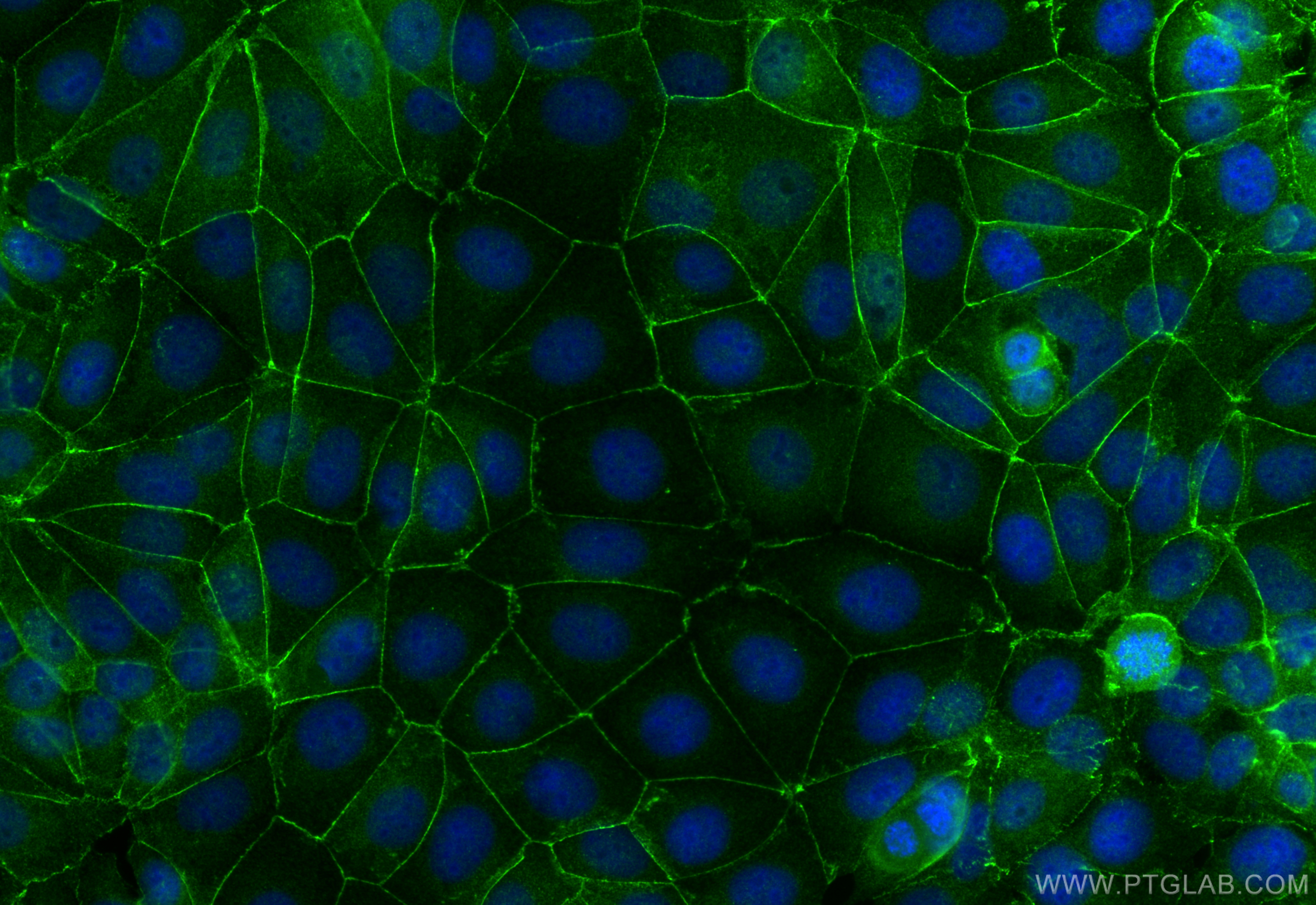 Immunofluorescence (IF) / fluorescent staining of MCF-7 cells using Nectin-4/PVRL4 Polyclonal antibody (21903-1-AP)