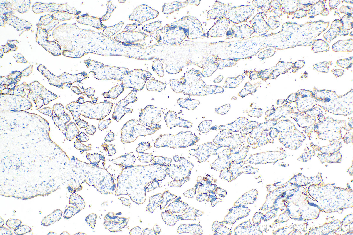 Immunohistochemistry (IHC) staining of human placenta tissue using Nectin-4/PVRL4 Polyclonal antibody (21903-1-AP)