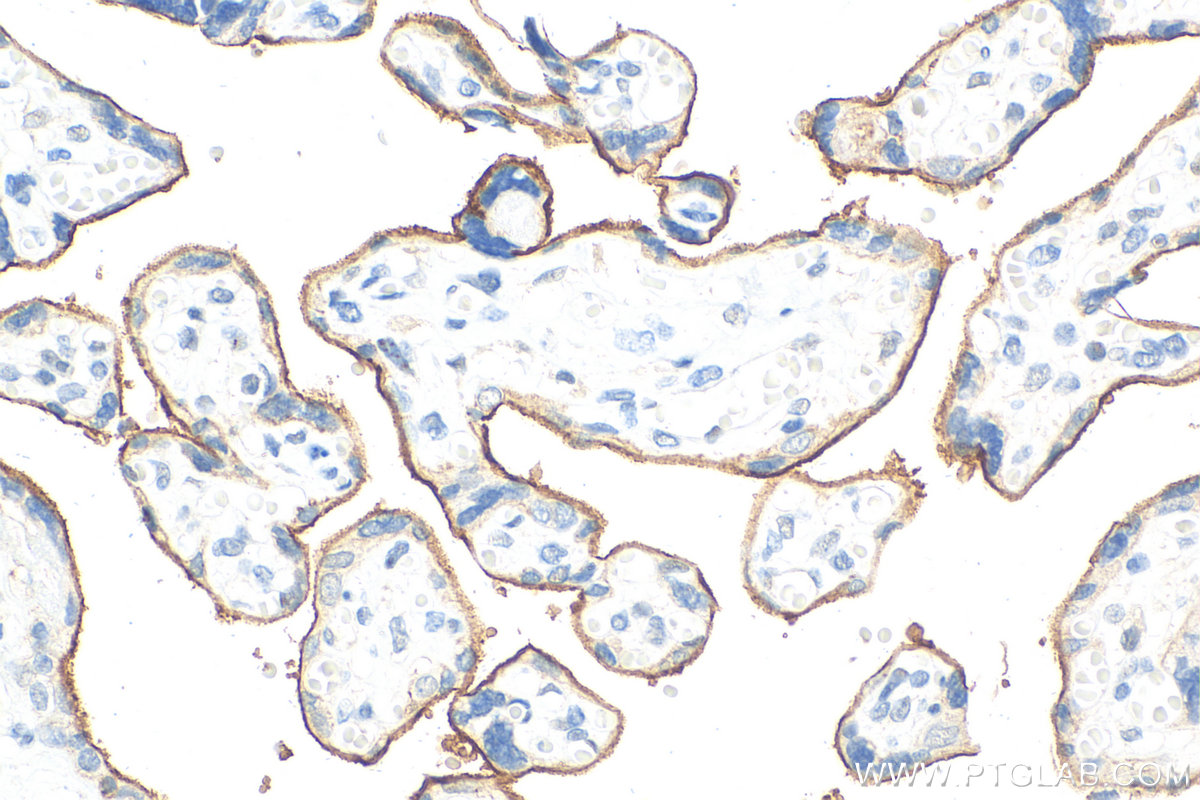 Immunohistochemistry (IHC) staining of human placenta tissue using Nectin-4/PVRL4 Polyclonal antibody (21903-1-AP)