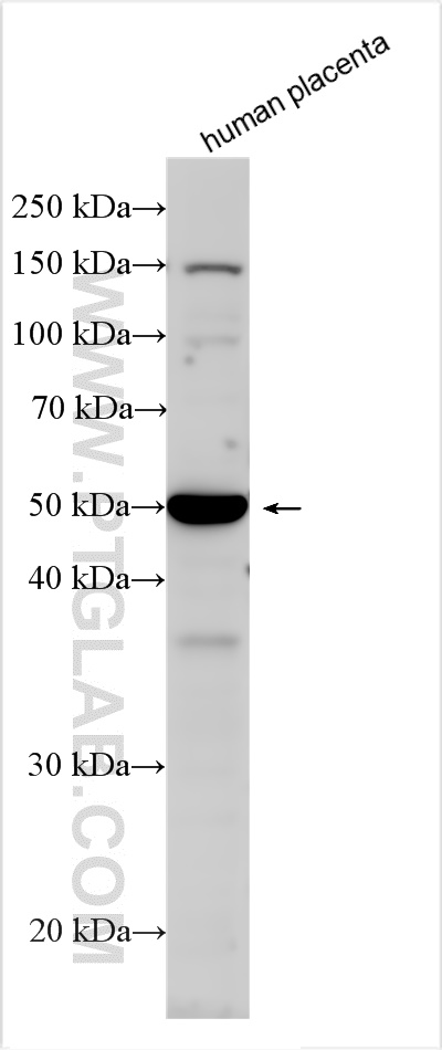 Western Blot (WB) analysis of various lysates using Nectin-4/PVRL4 Polyclonal antibody (21903-1-AP)