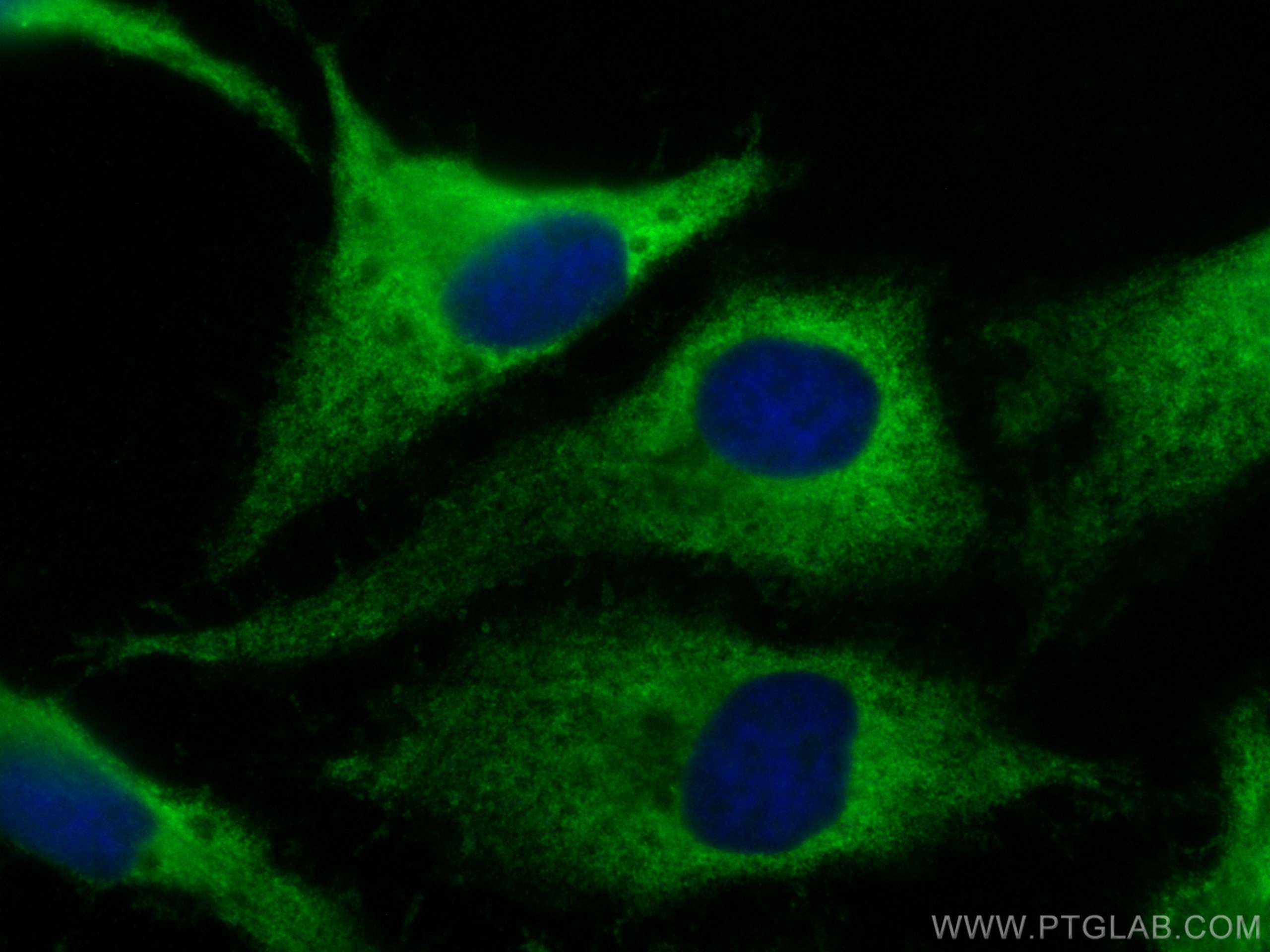 Immunofluorescence (IF) / fluorescent staining of HeLa cells using CoraLite® Plus 488-conjugated p130Cas / BCAR1 Poly (CL488-16815)