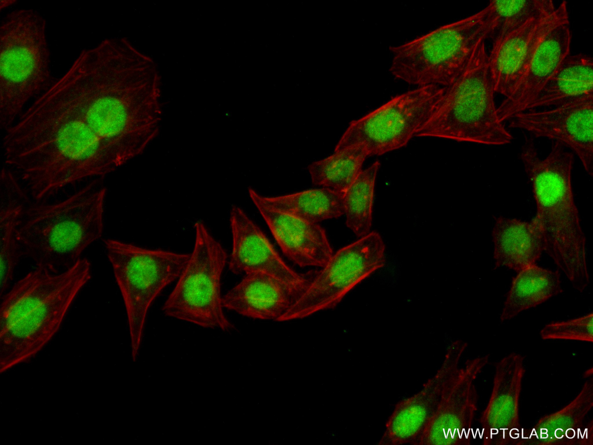 Immunofluorescence (IF) / fluorescent staining of HepG2 cells using p300 Recombinant antibody (83078-4-RR)